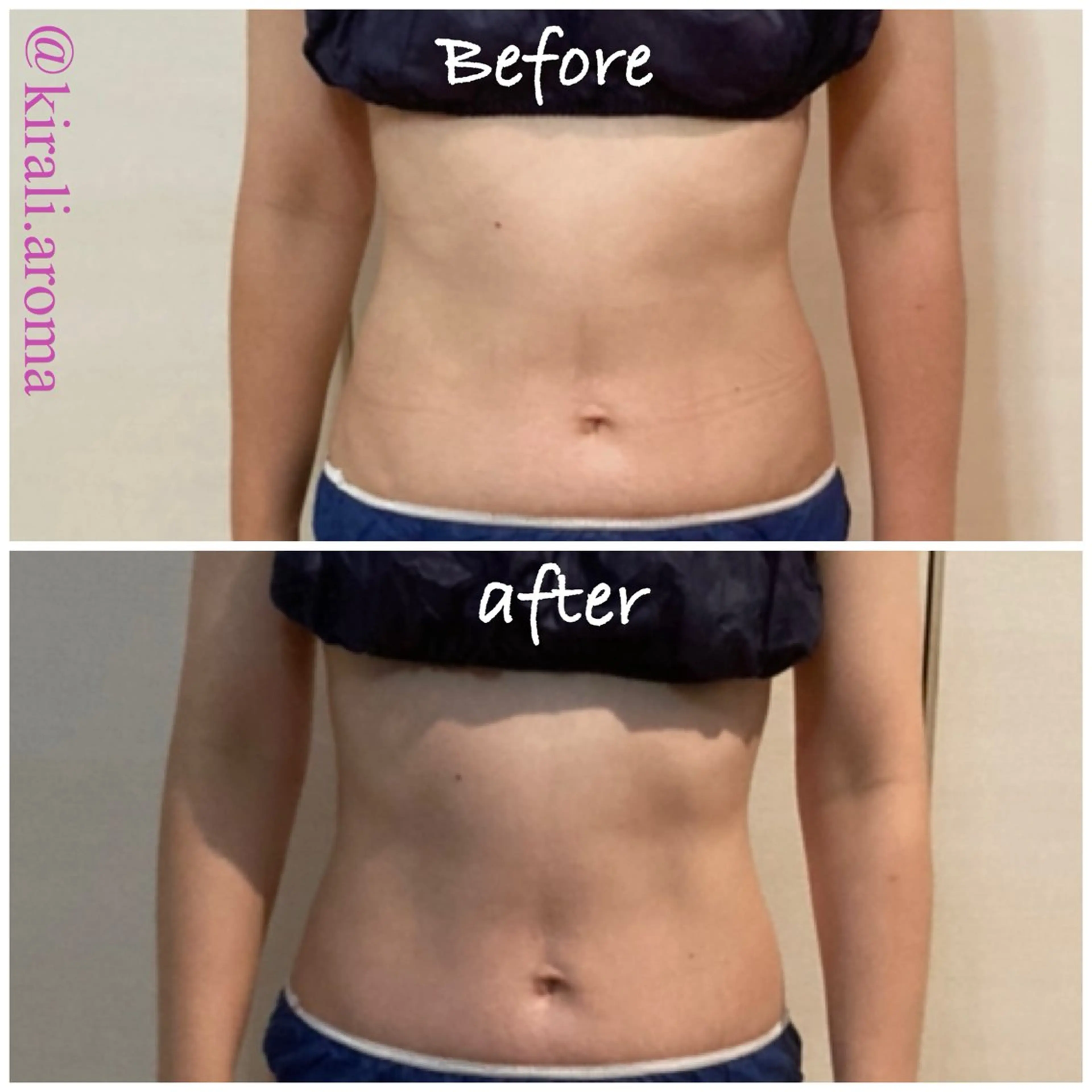 腸セラピー&若よもぎ蒸しの写真