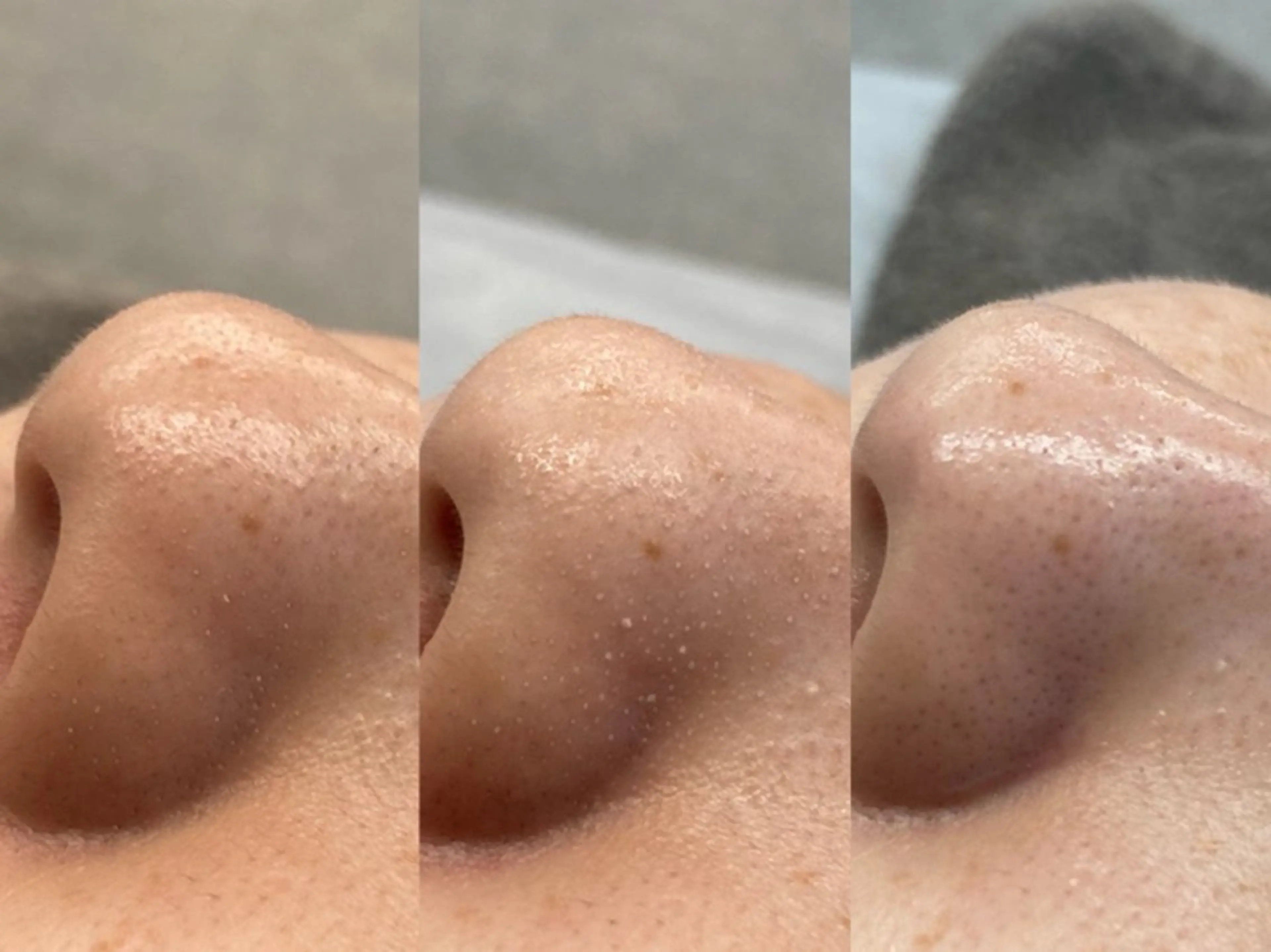 NICORI　小顔&肌質改善専門店所属・小顔＆肌質改善 NICORIのエステ・リラクイメージ