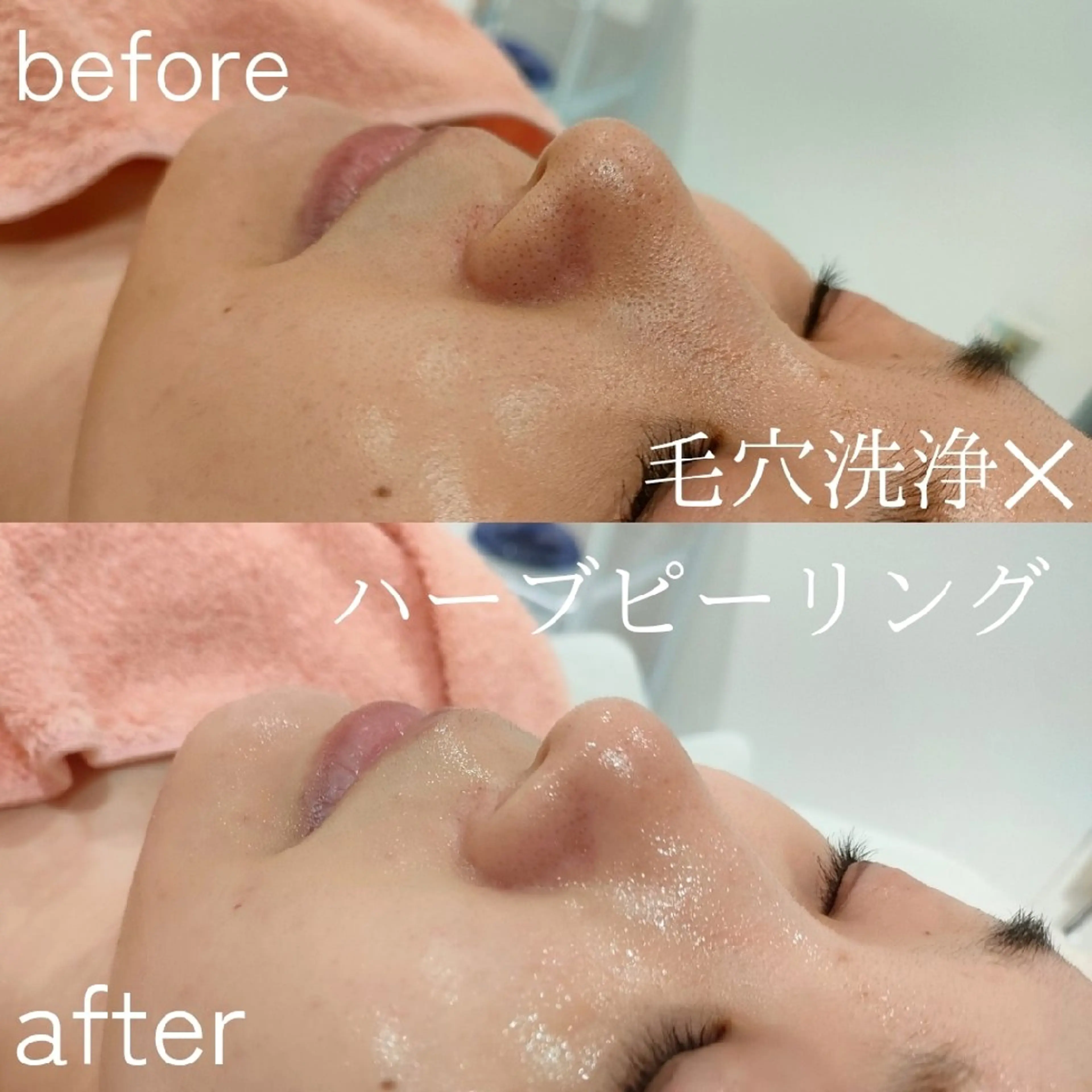 エステ 美肌脱毛＆小顔・フェ イシャル【SONA】のエステ・リラクイメージ