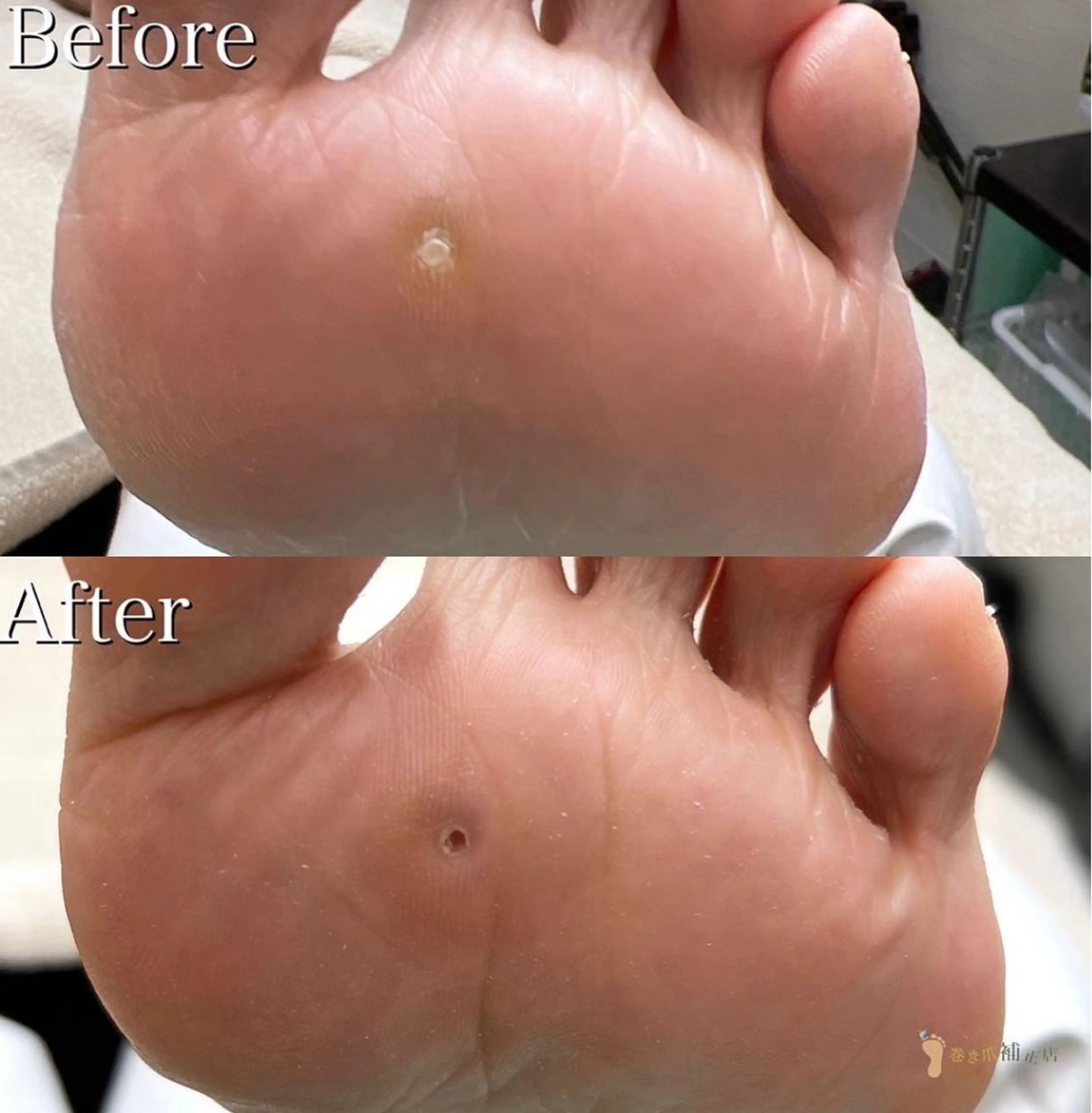 リラク 福岡巻き爪補正店 博多店のエステ・リラクイメージ