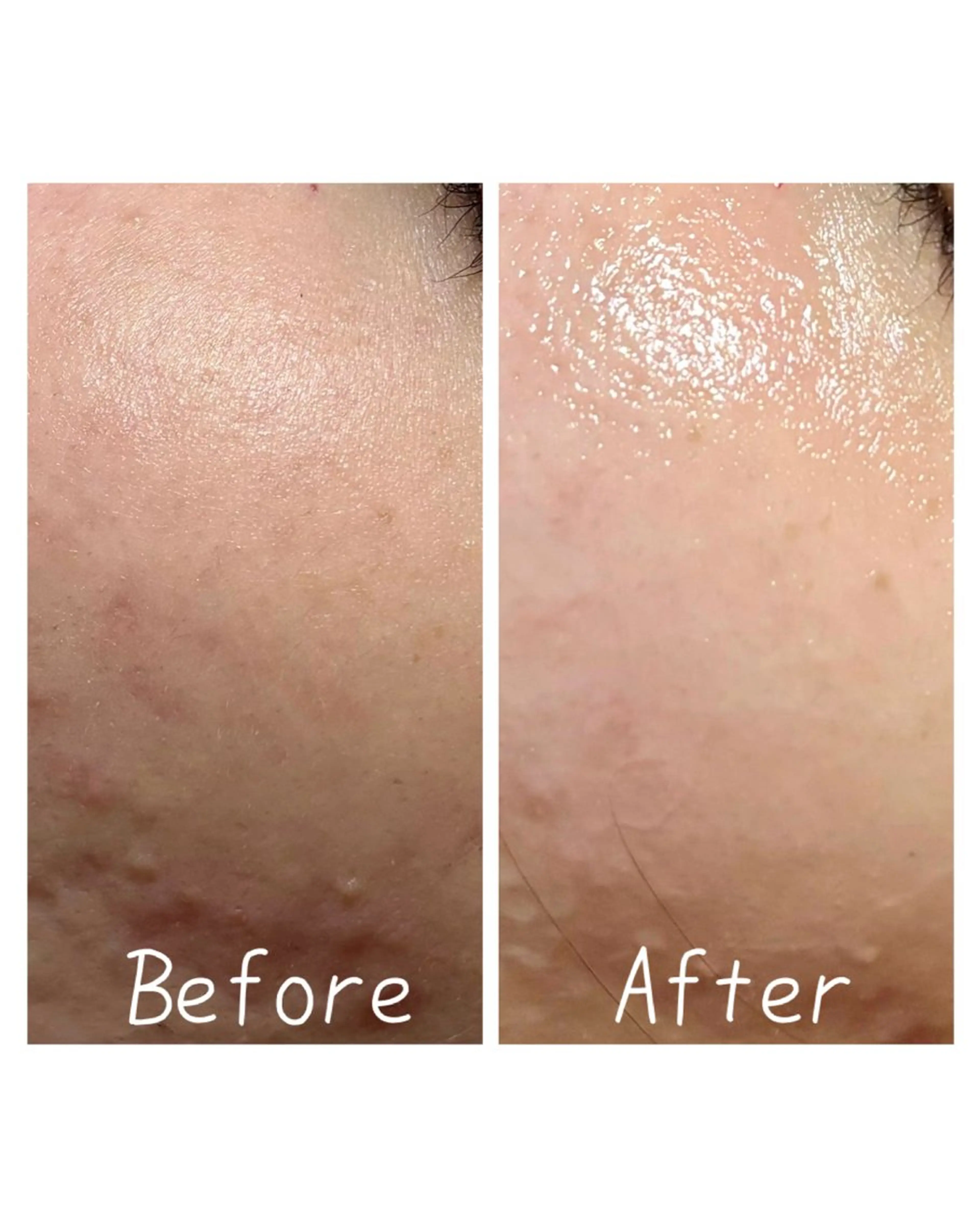 エステ 肌質改善Charme coco  増毛のエステ・リラクイメージ