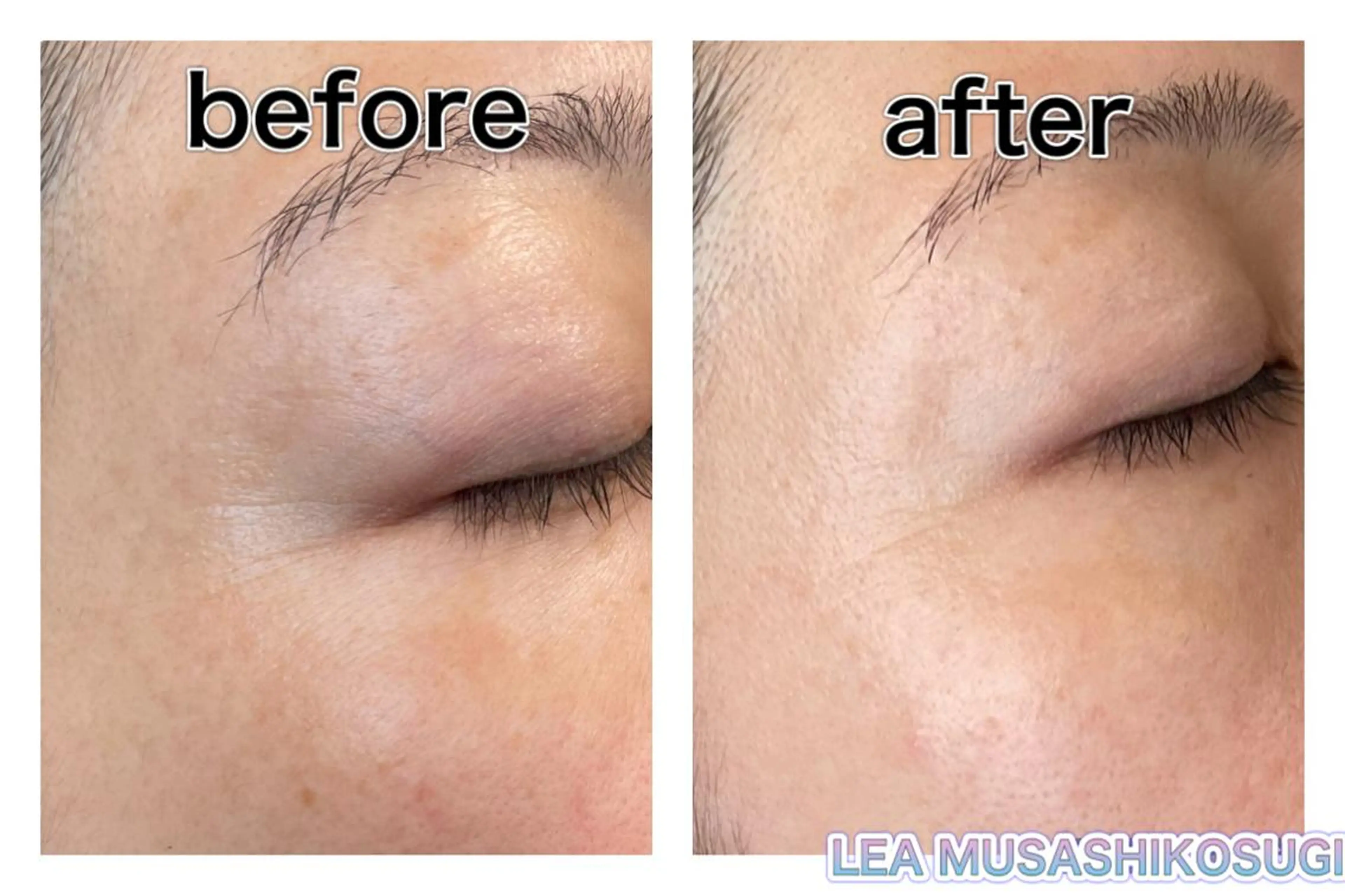 LEA MUSASHIKOSUGI所属・美肌育成サロン LEA武蔵小杉のエステ・リラクイメージ