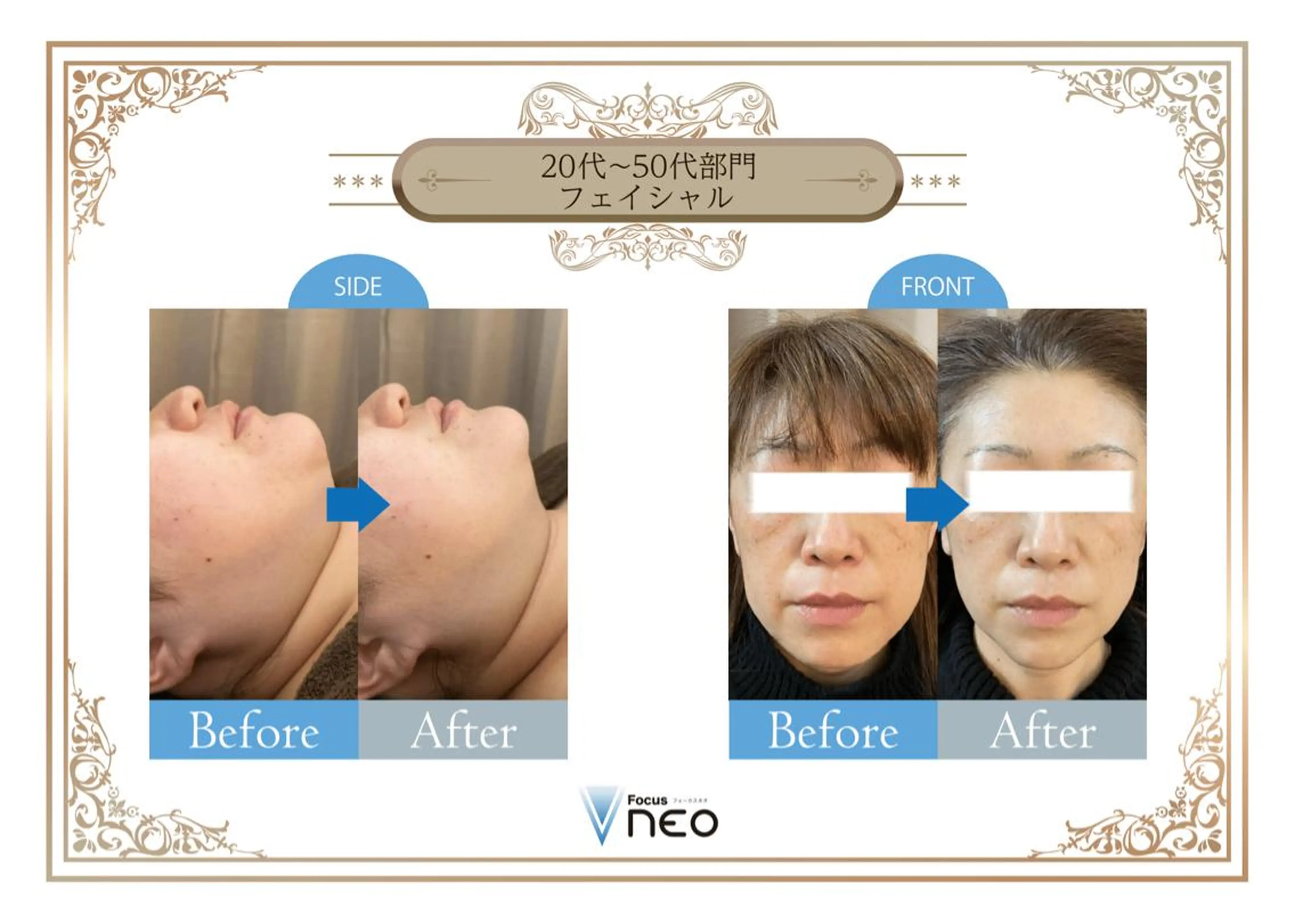 毛穴/肌質改善サロン クレアベレッツァのエステ・リラクイメージ