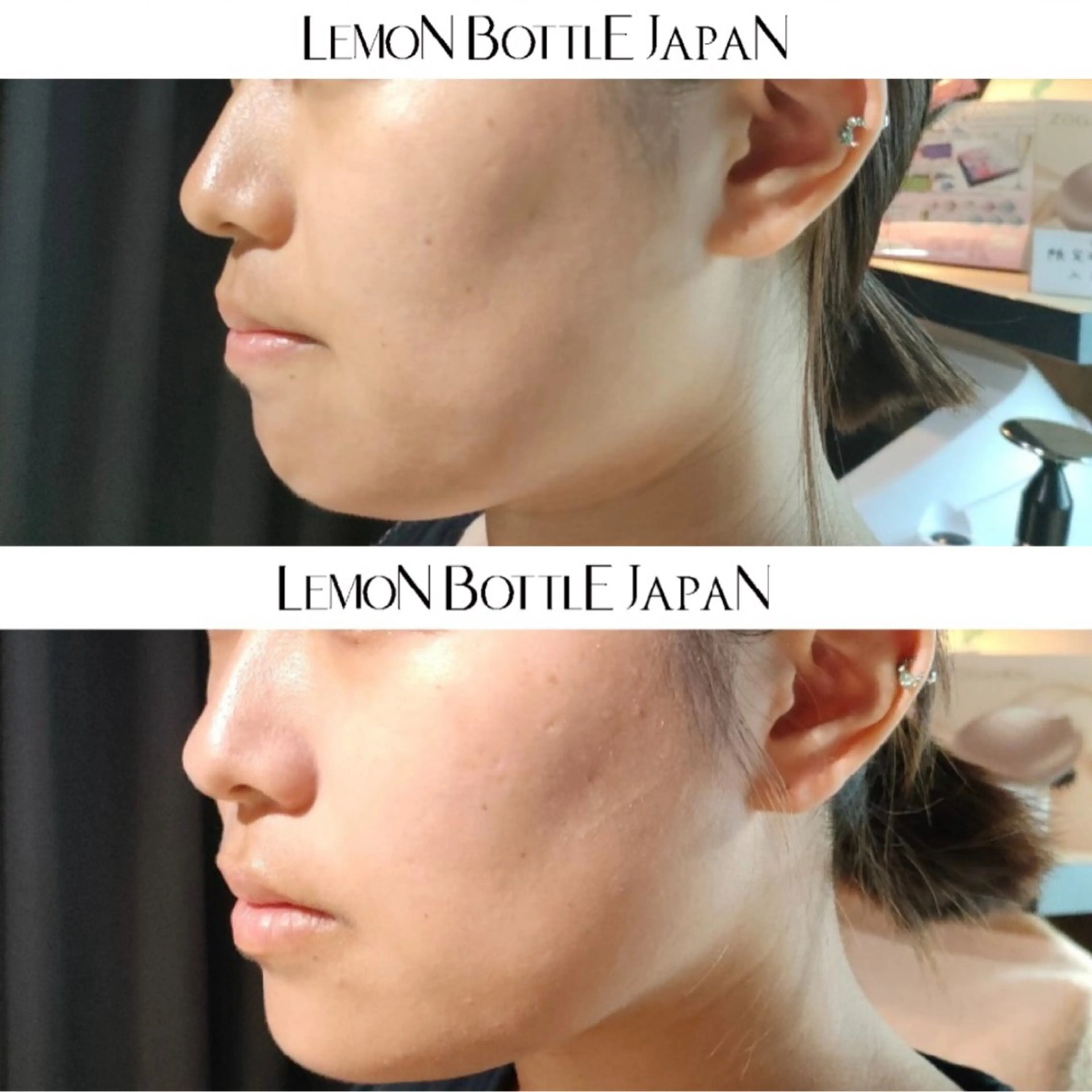 看護師が施術する ナスサロ/Emi🪽のエステ・リラクイメージ