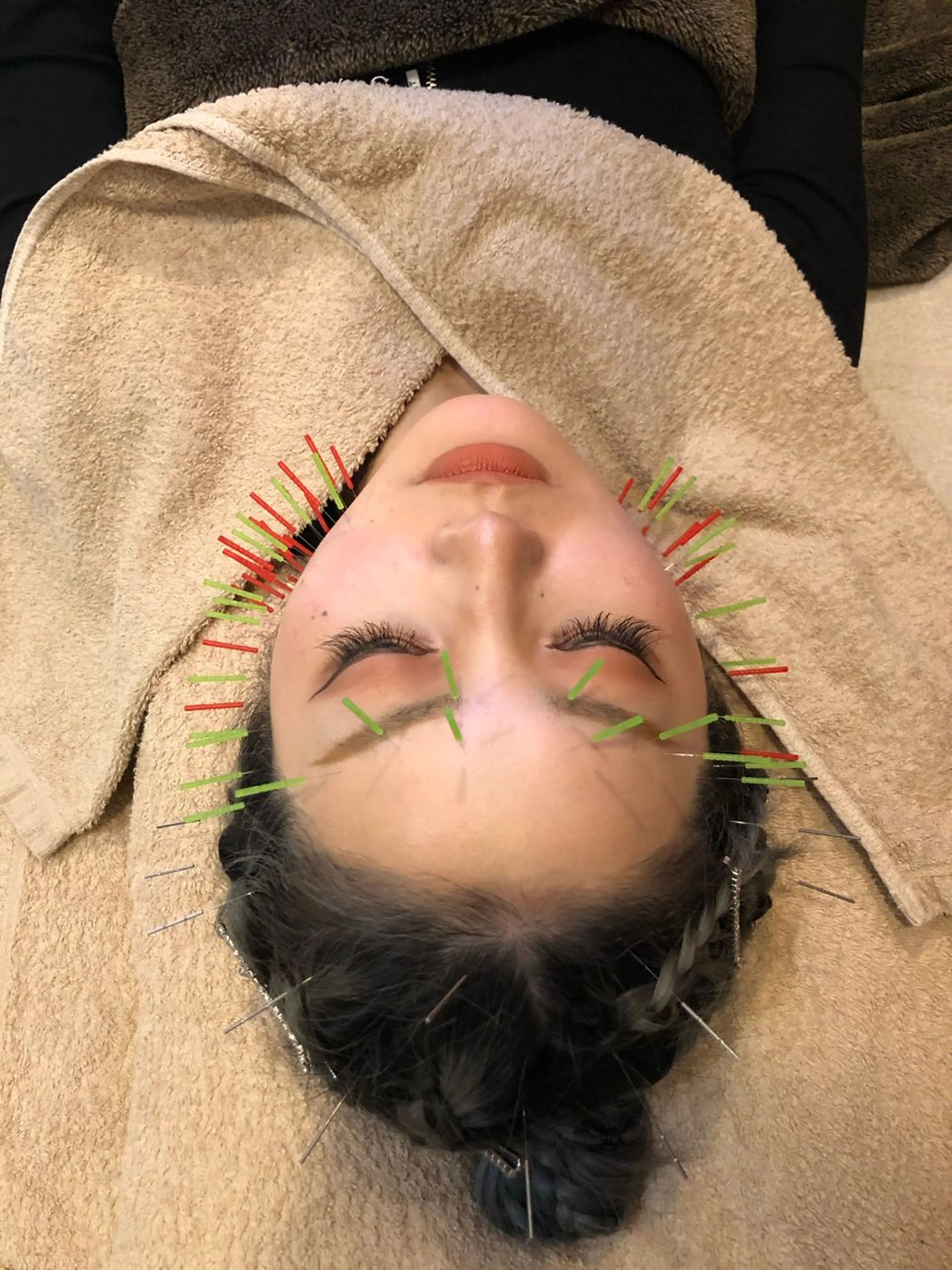 THE  ROOTS所属・美容鍼♡小顔矯正♡ fumikaのエステ・リラクイメージ