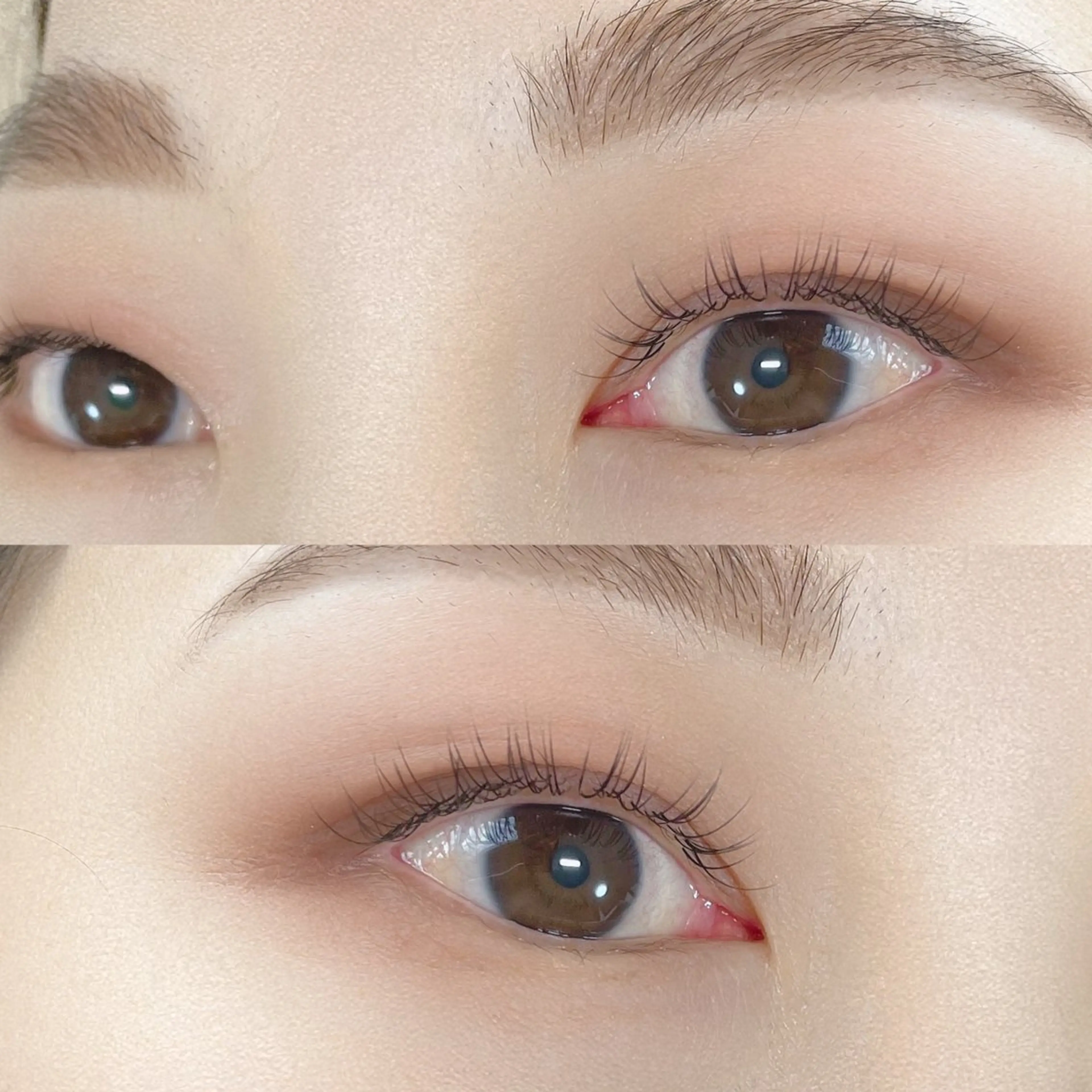 フラットラッシュ100本の写真