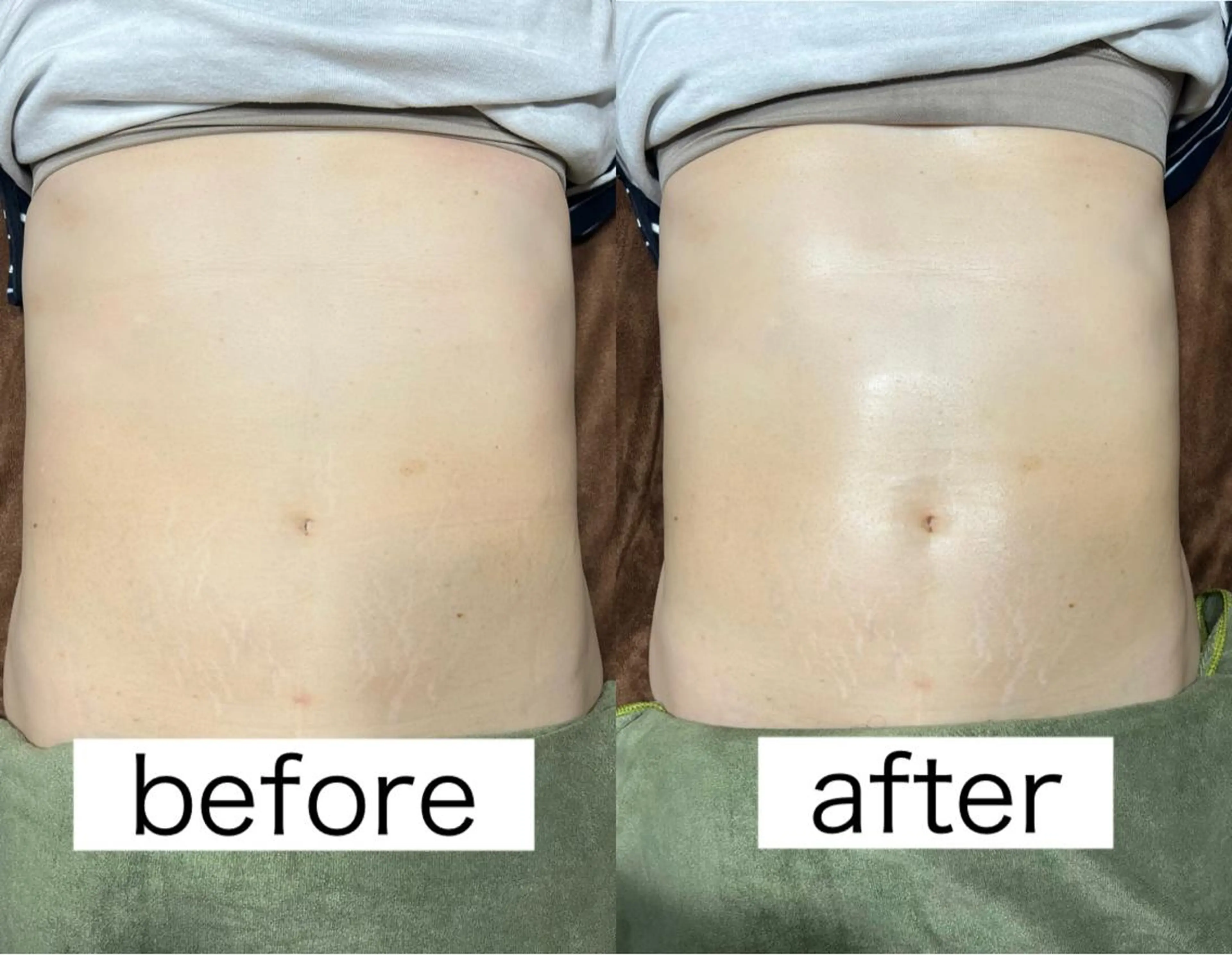 Beauty   Salon  Adiy所属・Adiy ikumiのエステ・リラクイメージ