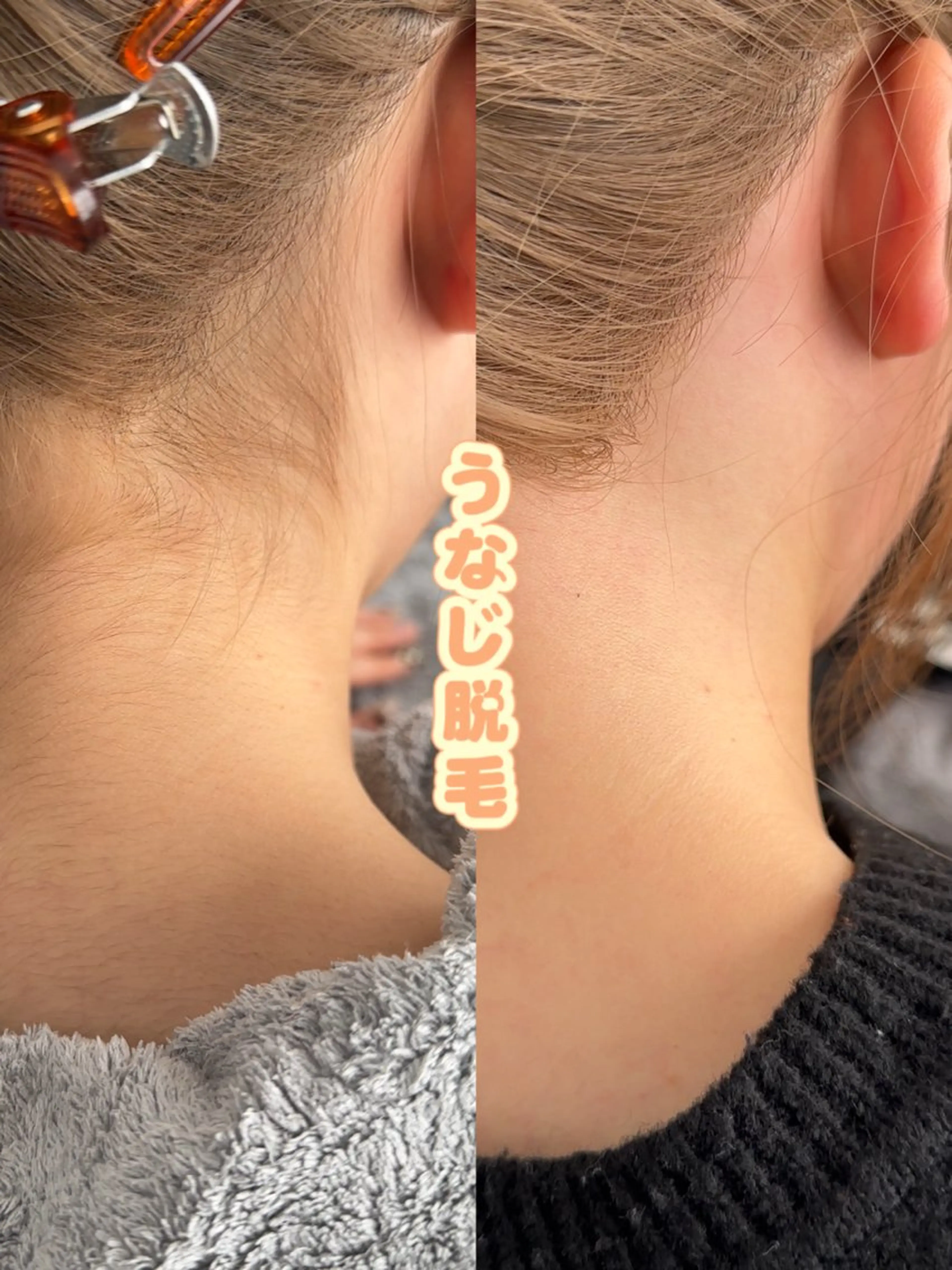 Hit. シュガーリング豊橋のエステ・リラクイメージ