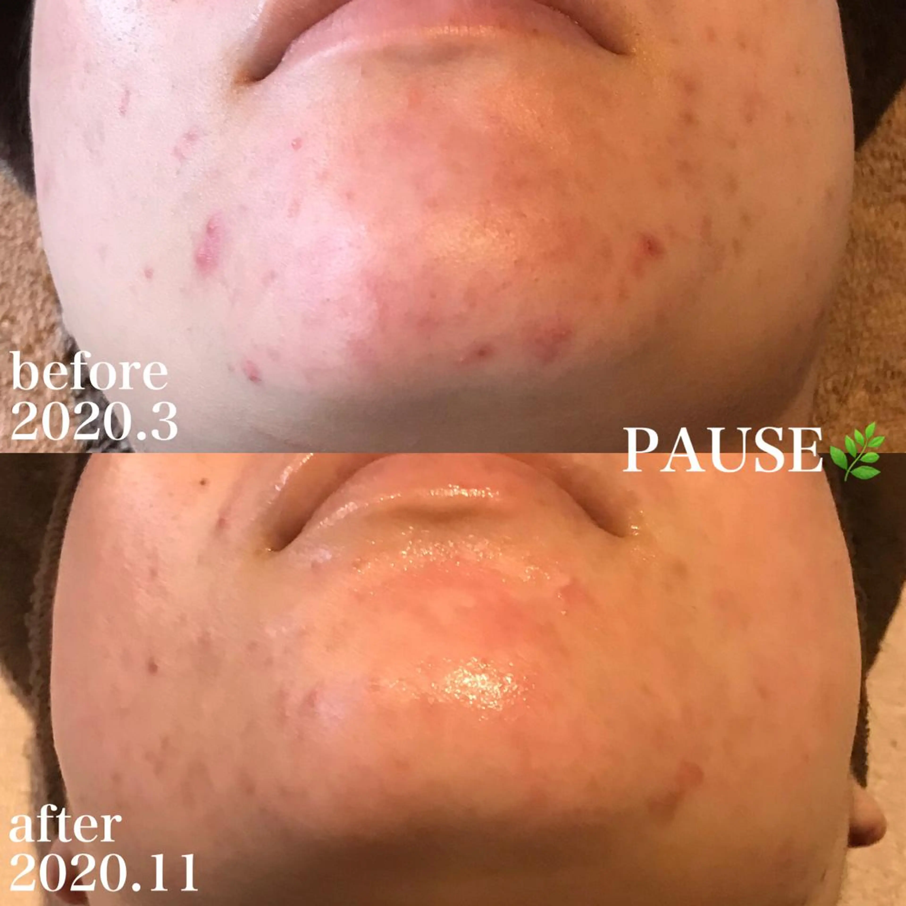 エステ 浜野 恵美のエステ・リラクイメージ