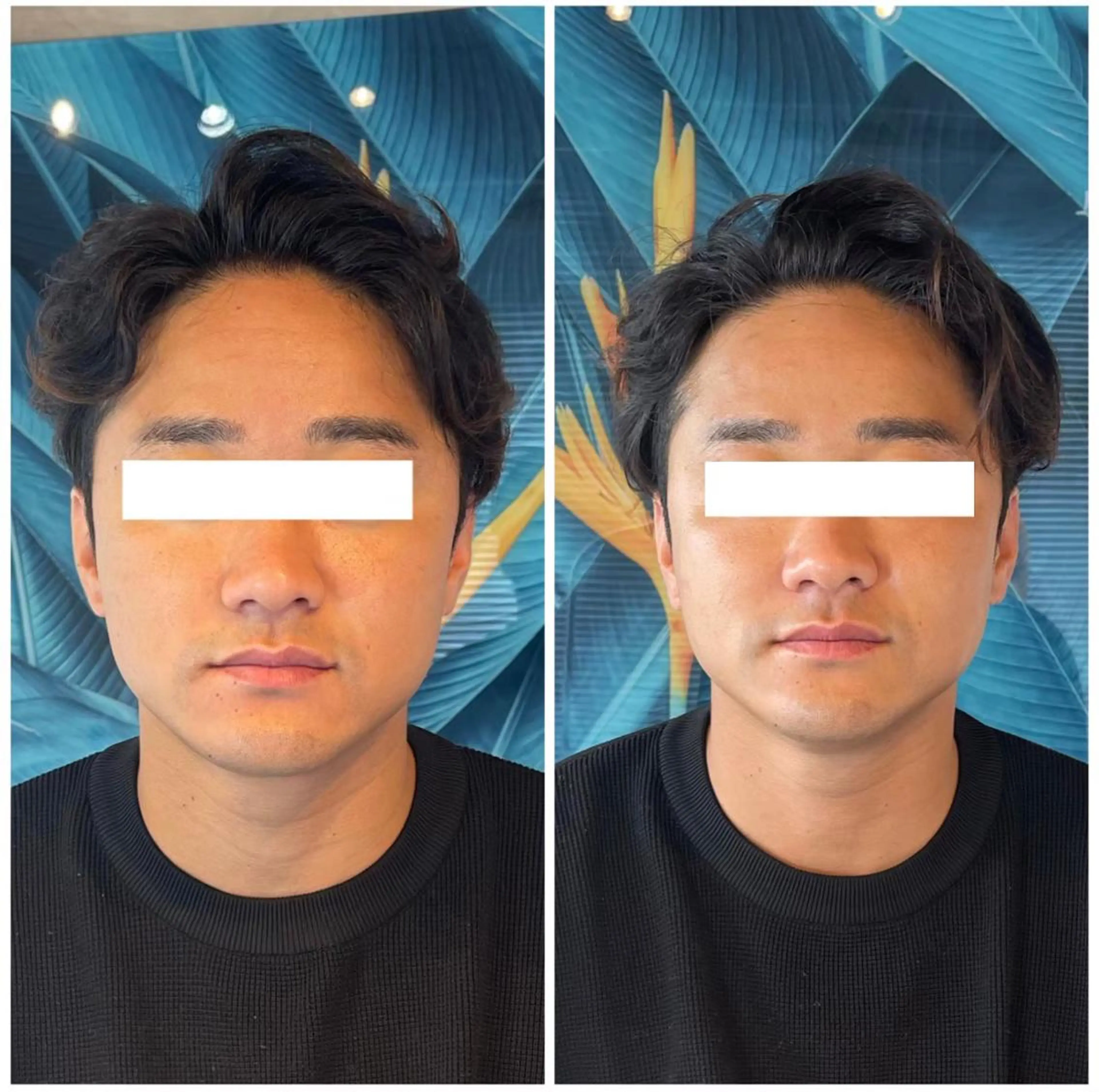 エステ リラク 部分痩せ♥️小顔専門 MIKUのエステ・リラクイメージ