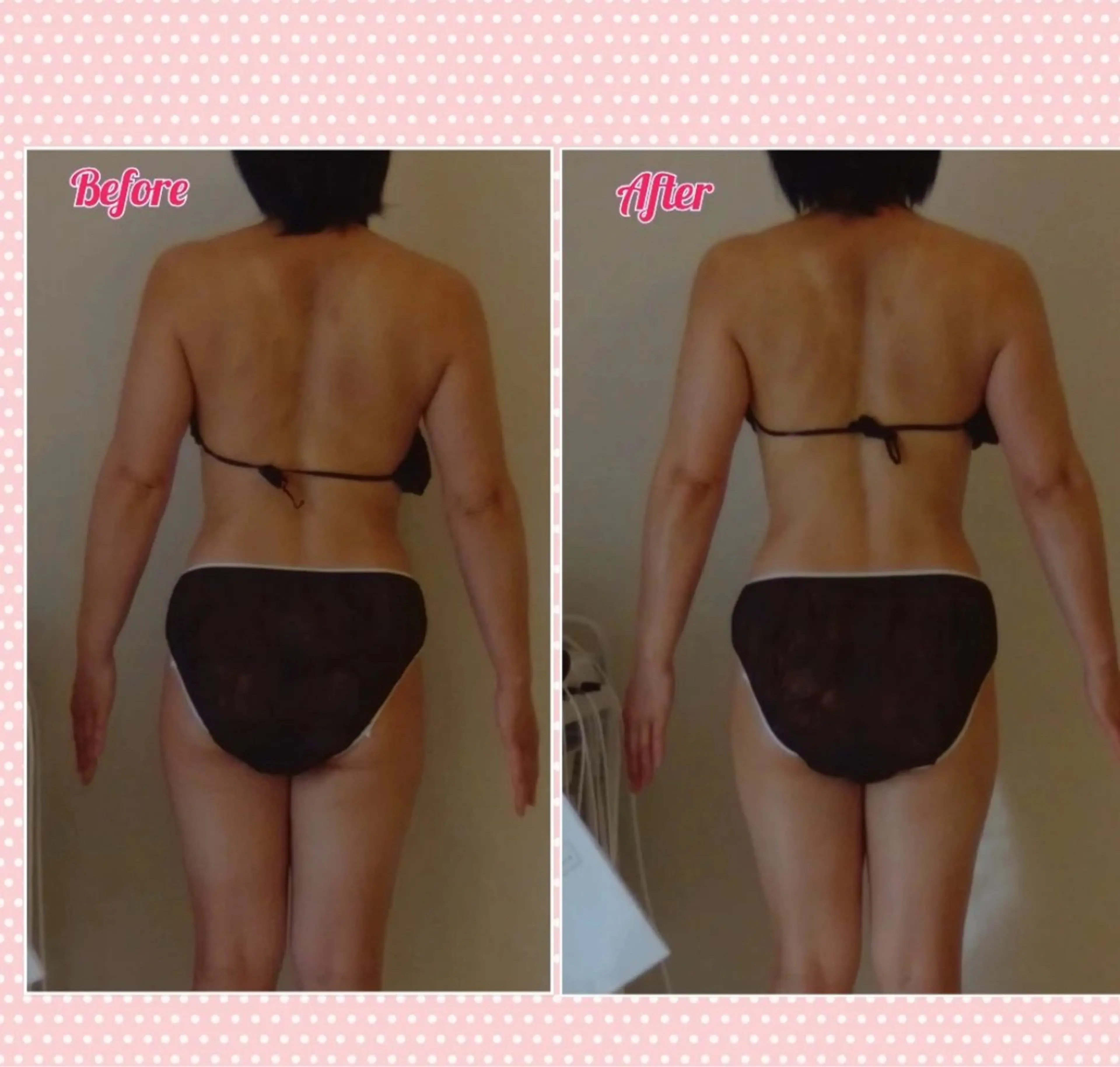 B.B  SALON所属・鎌田 望のエステ・リラクイメージ