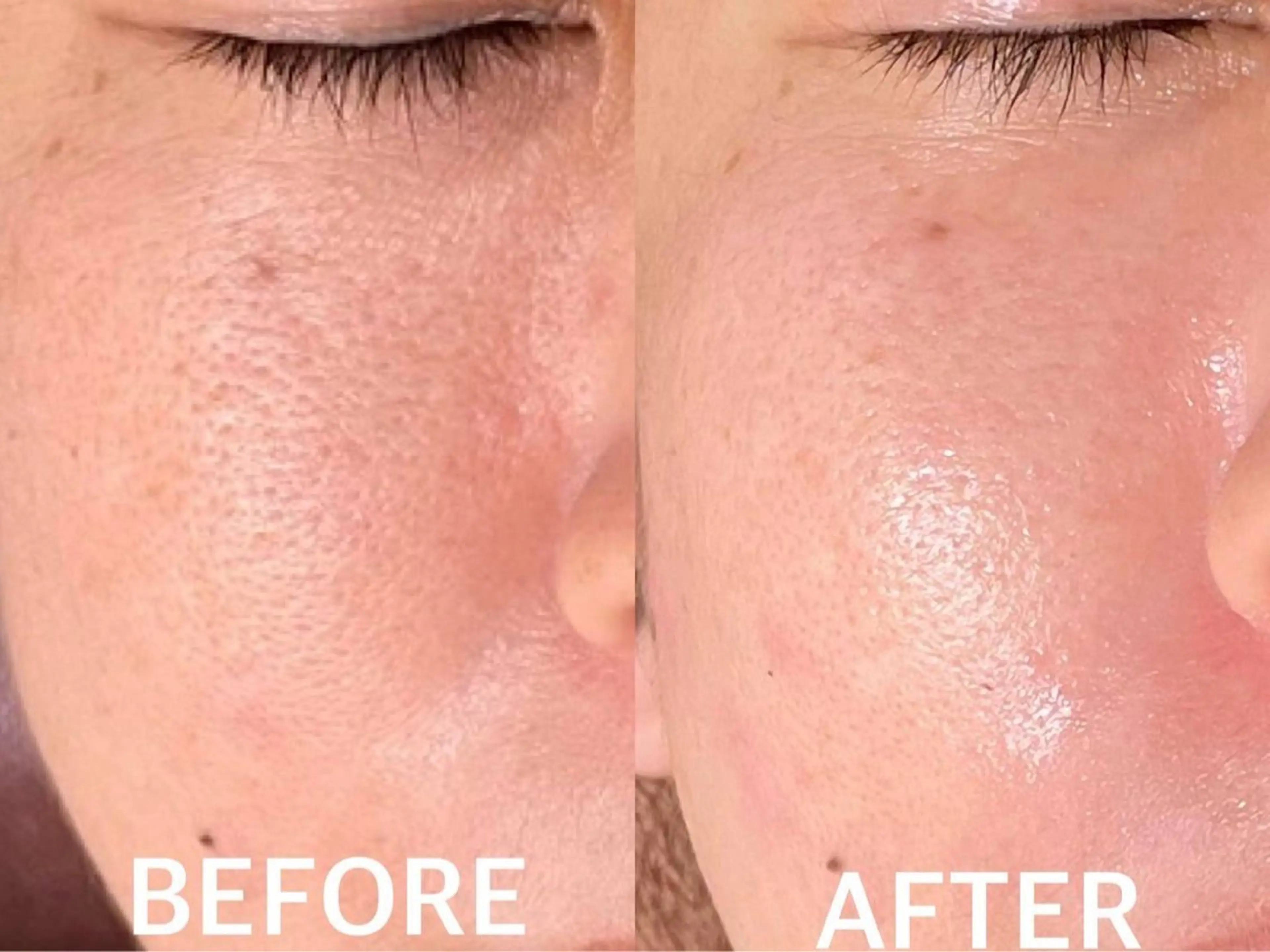 ハーブピーリング 🌿京橋のエステ・リラクイメージ