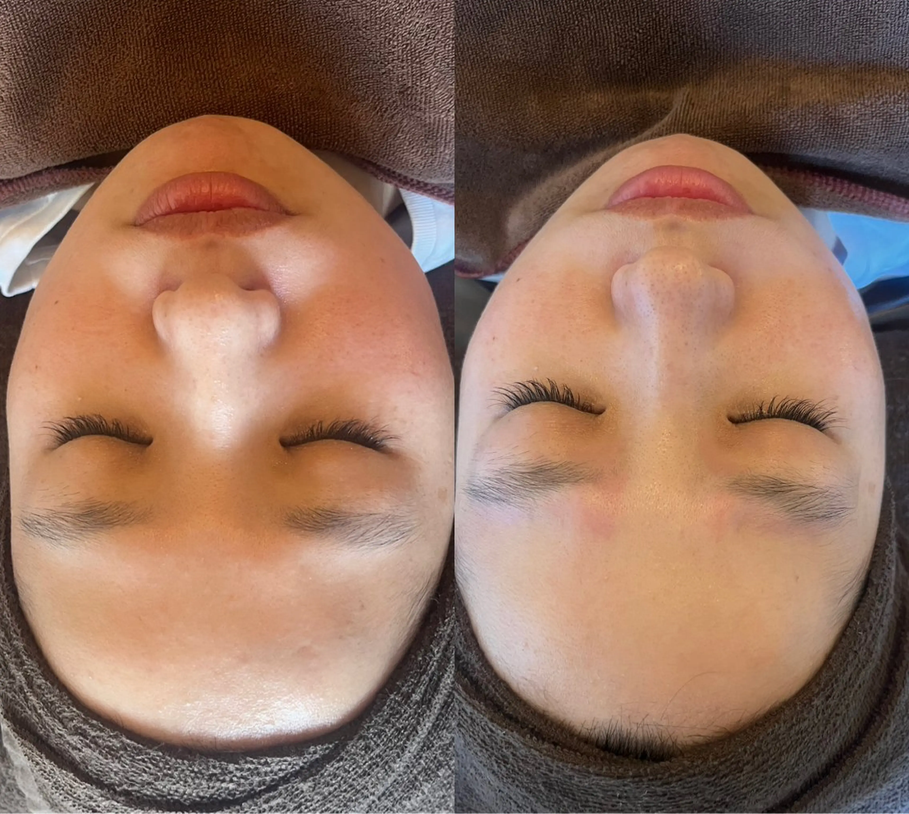 oyam オヤムのエステ・リラクイメージ