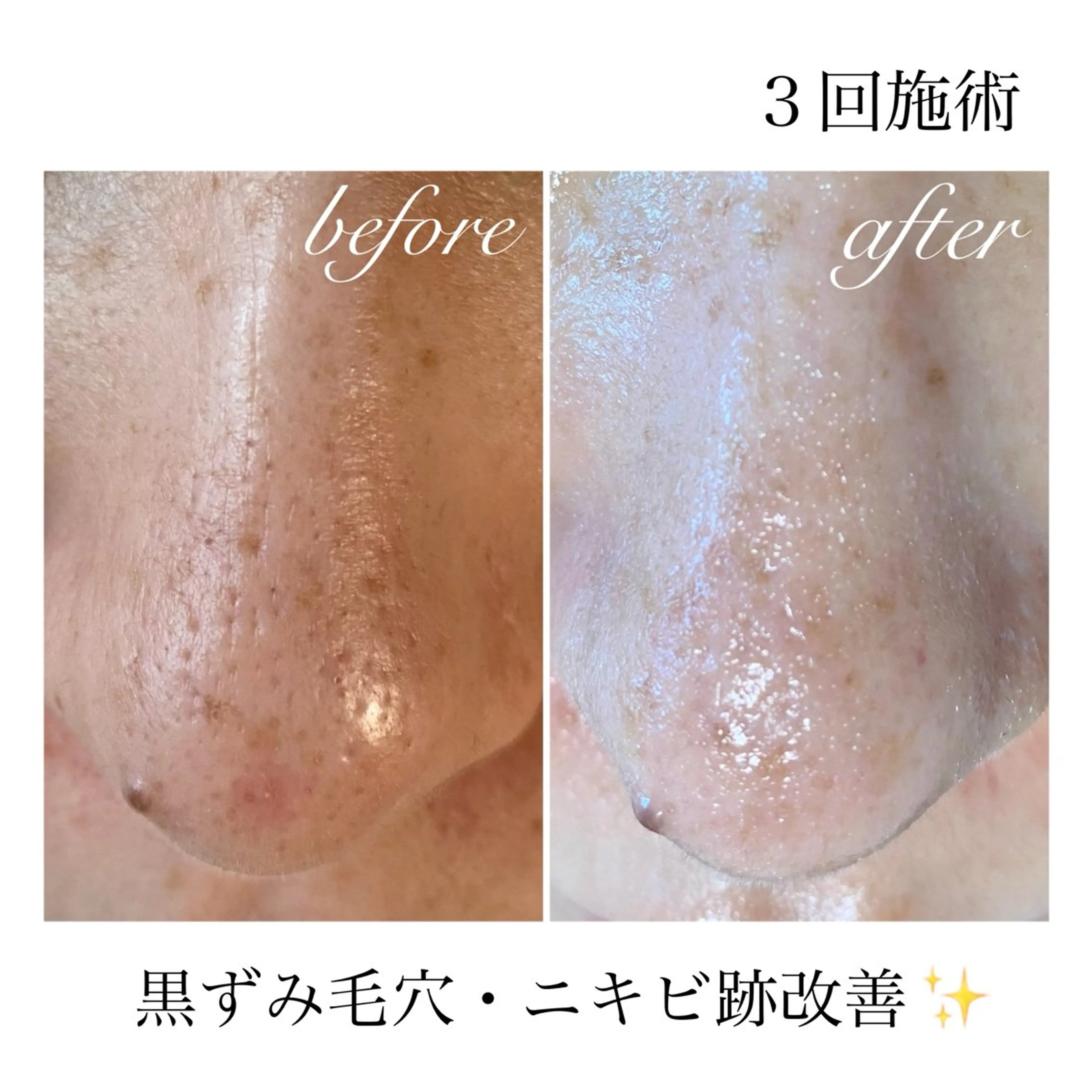 エステ リラク ダイエット・美肌ケア fleurのエステ・リラクイメージ