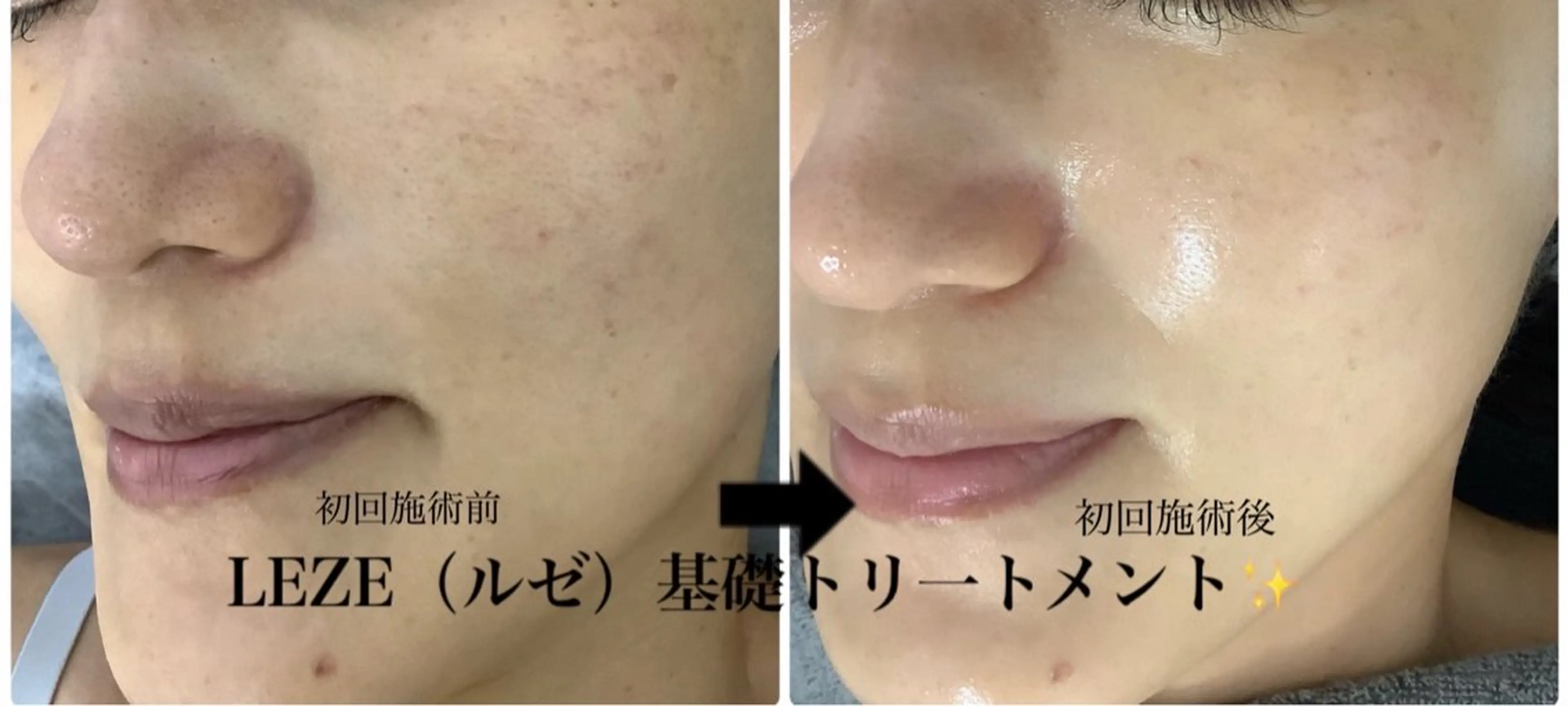 エステ 🩵Tatsumi Kana🩵のエステ・リラクイメージ