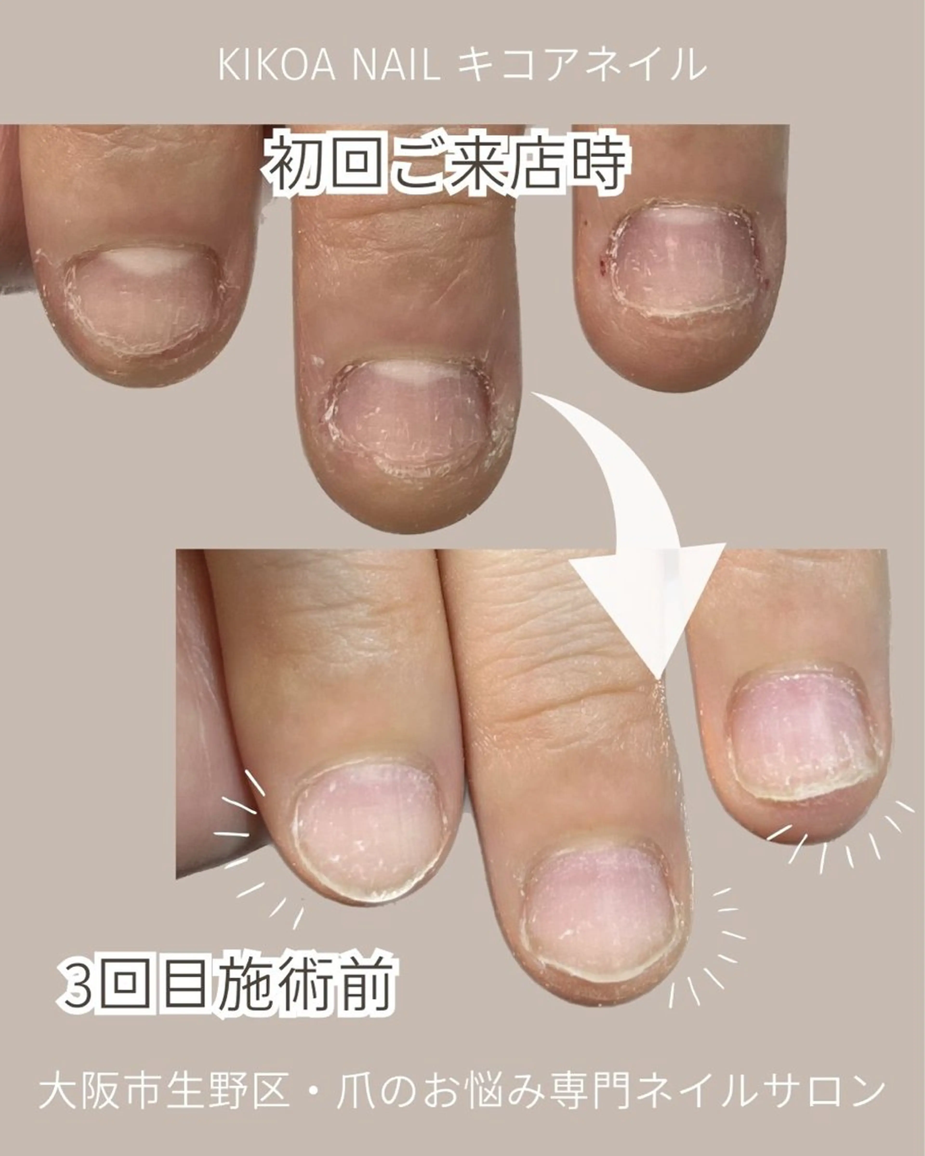 ネイル KIKOA NAIL キコアネイルのネイルデザイン