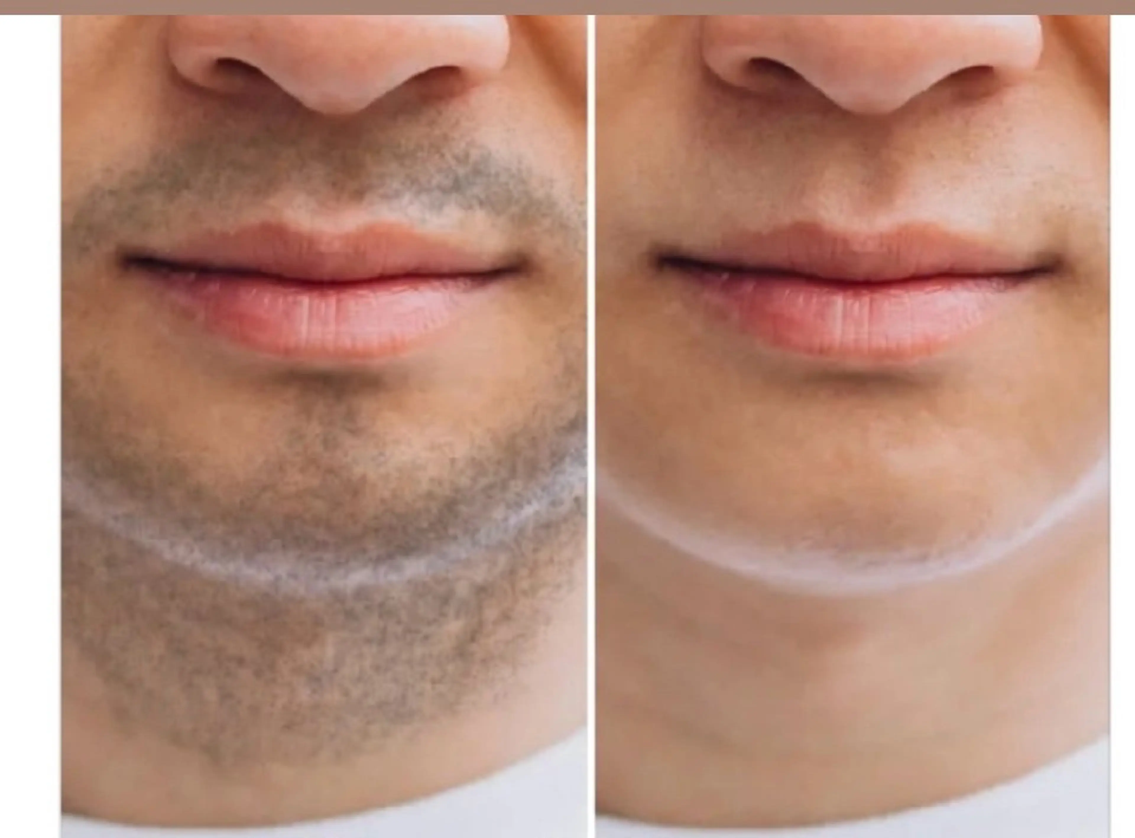 エステ 痩身&小顔専門 REBORN赤井愛美のエステ・リラクイメージ