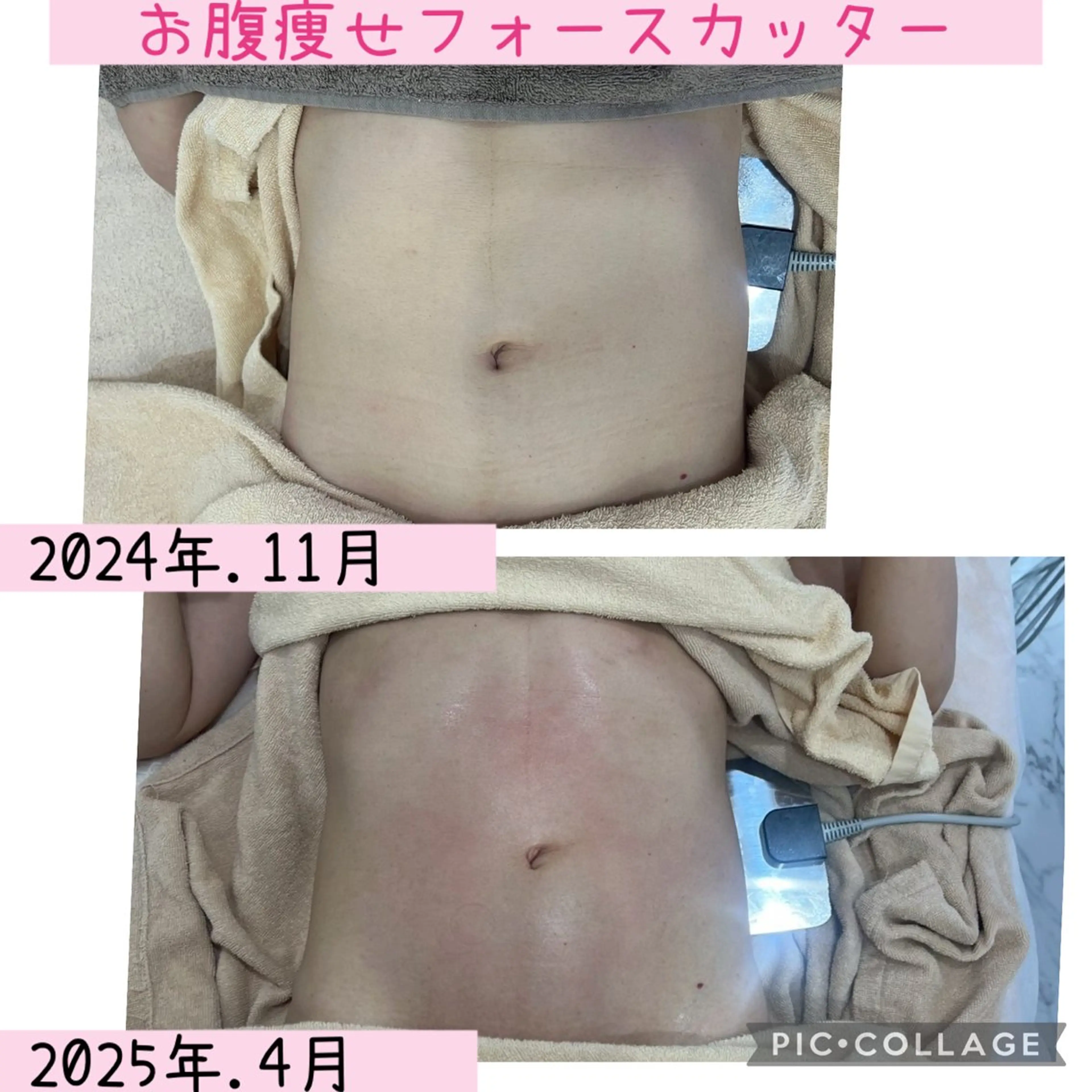 エステ ブライダル痩身×脱毛 尼崎駅前サロンのエステ・リラクイメージ