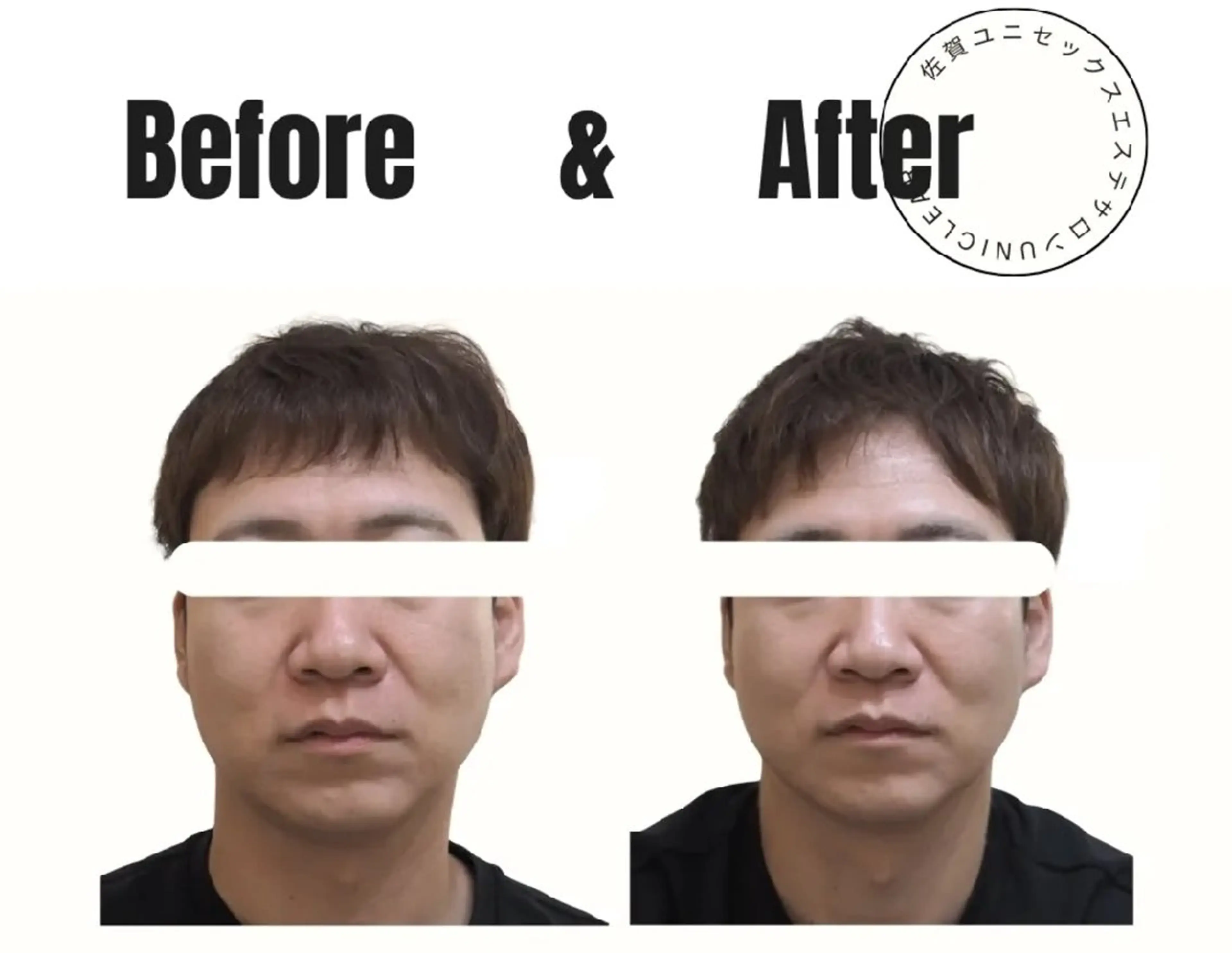 エステ ユニセックスエステサロンUniclear所属・痩身&フェイシャル Uniclearのエステ・リラクイメージ