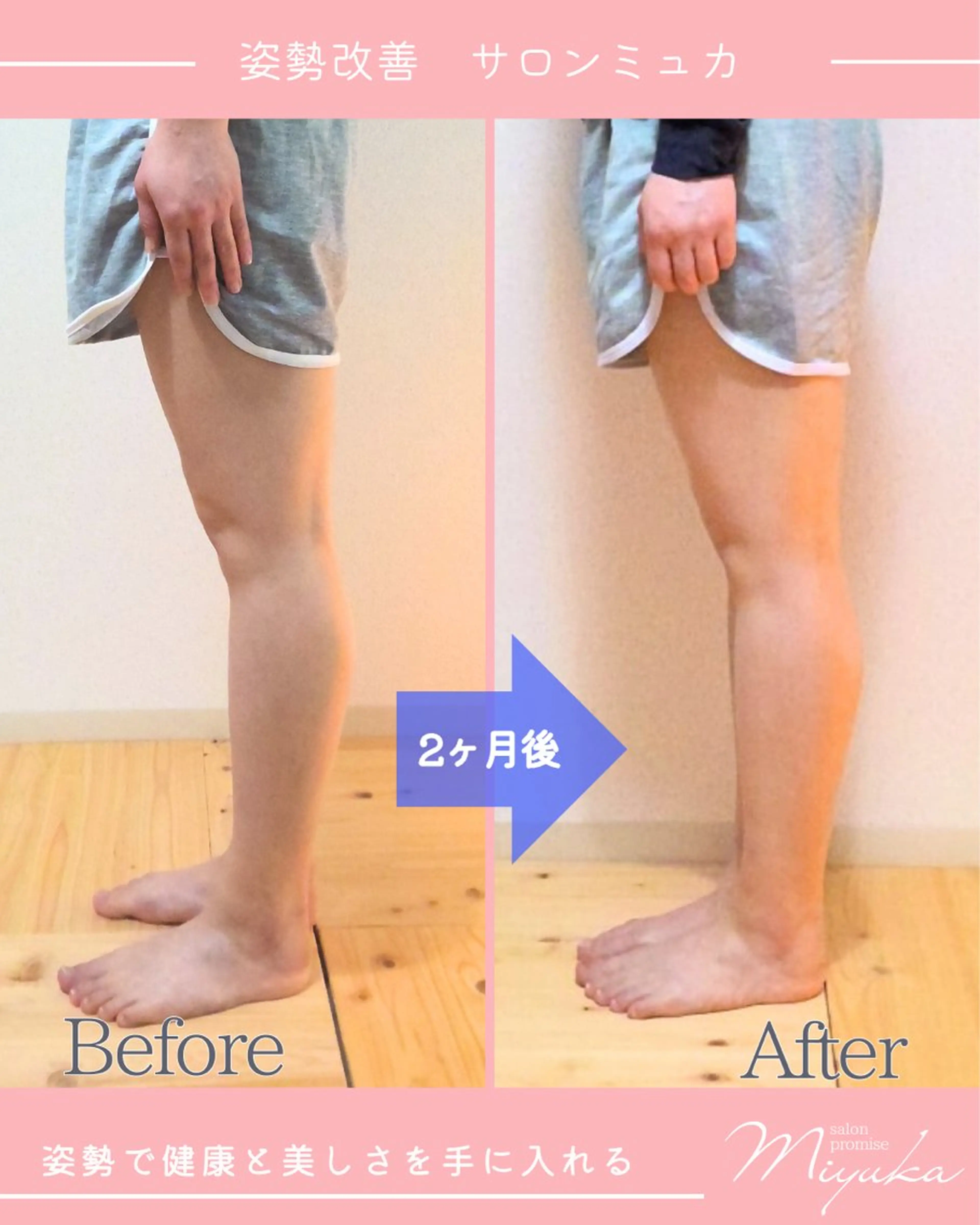 姿勢改善サロン ミュカのエステ・リラクイメージ