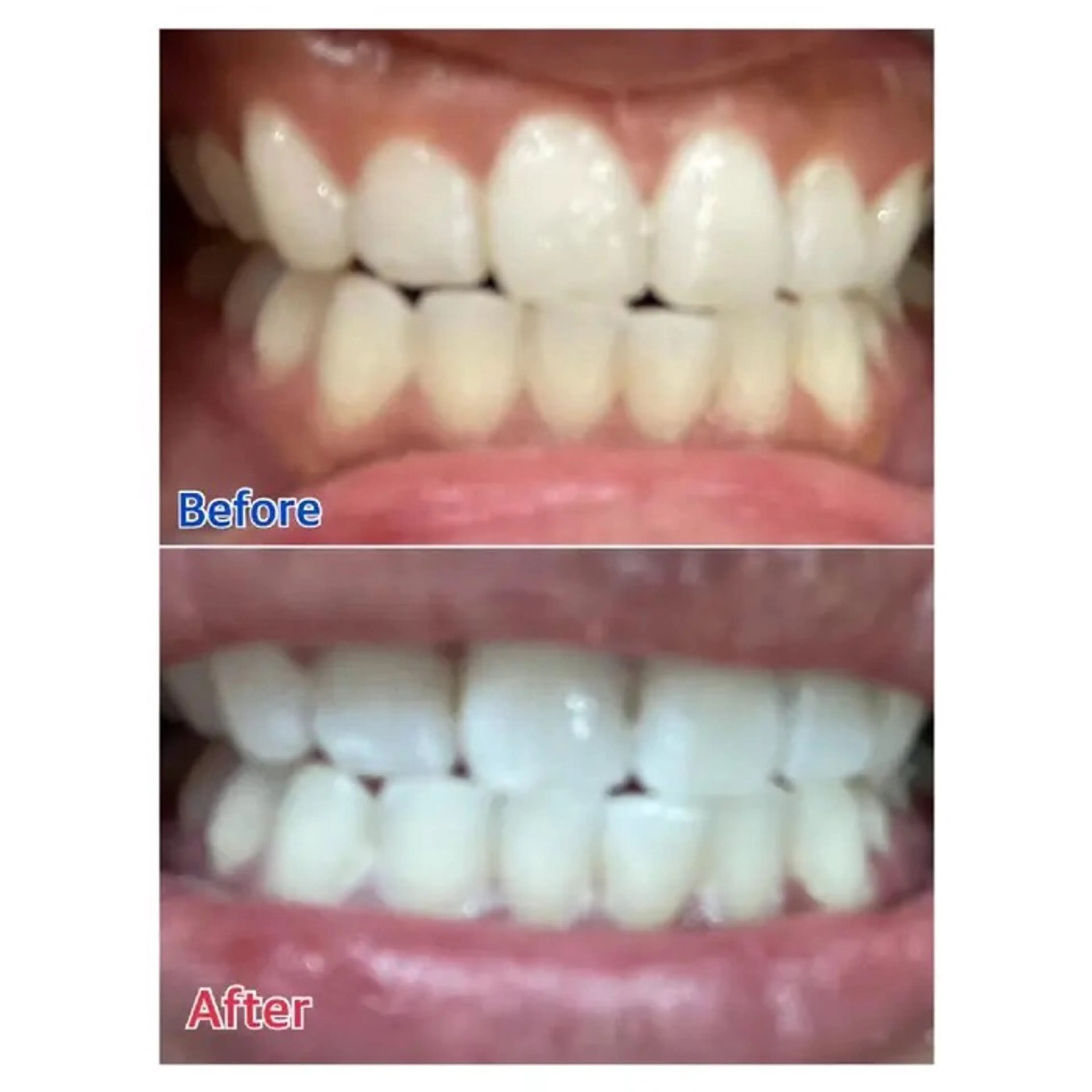 M渋谷店所属・Ｍ渋谷 ホワイトニングのその他イメージ