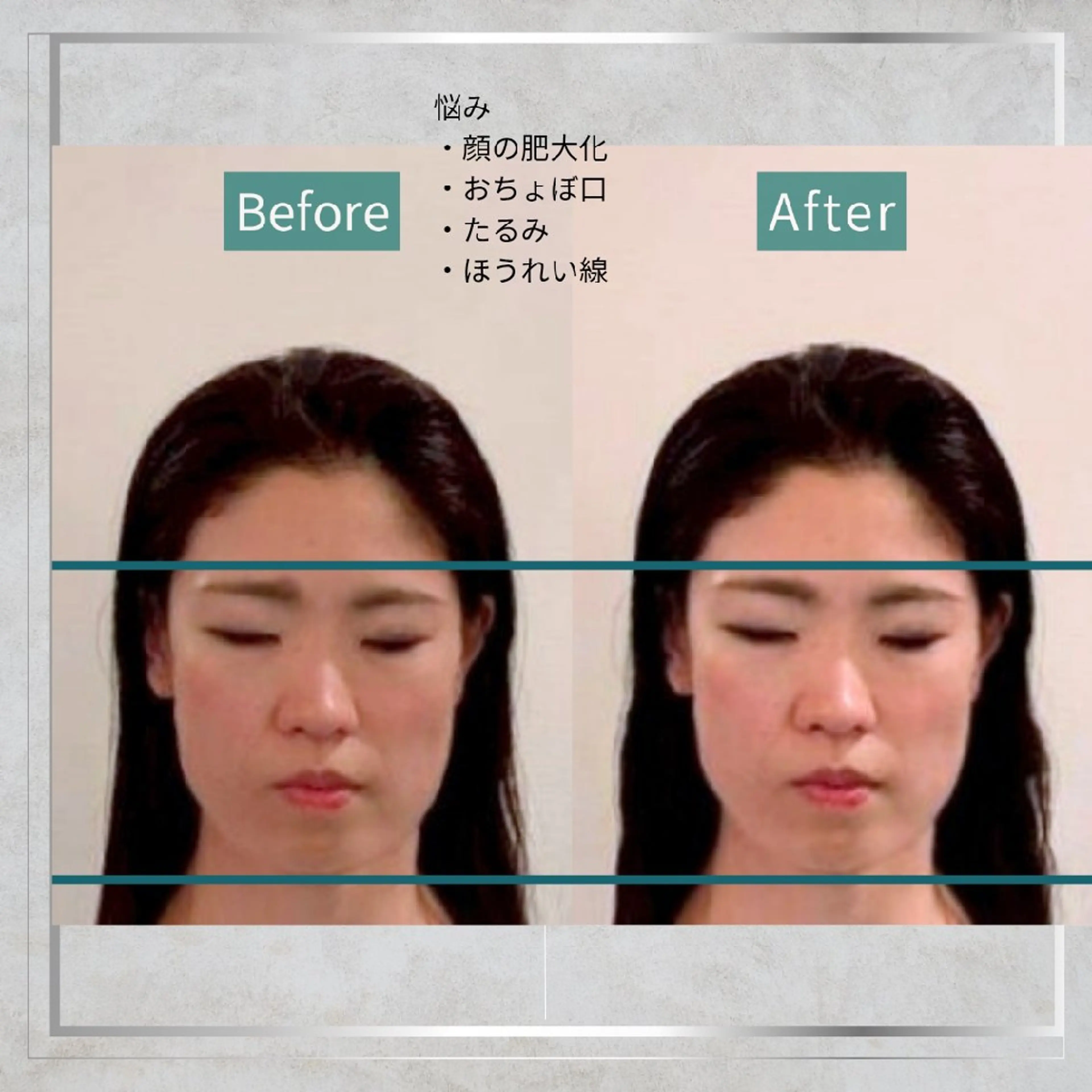 エステ リラク KANWA鍼灸院所属・KANWA 鍼灸院のエステ・リラクイメージ