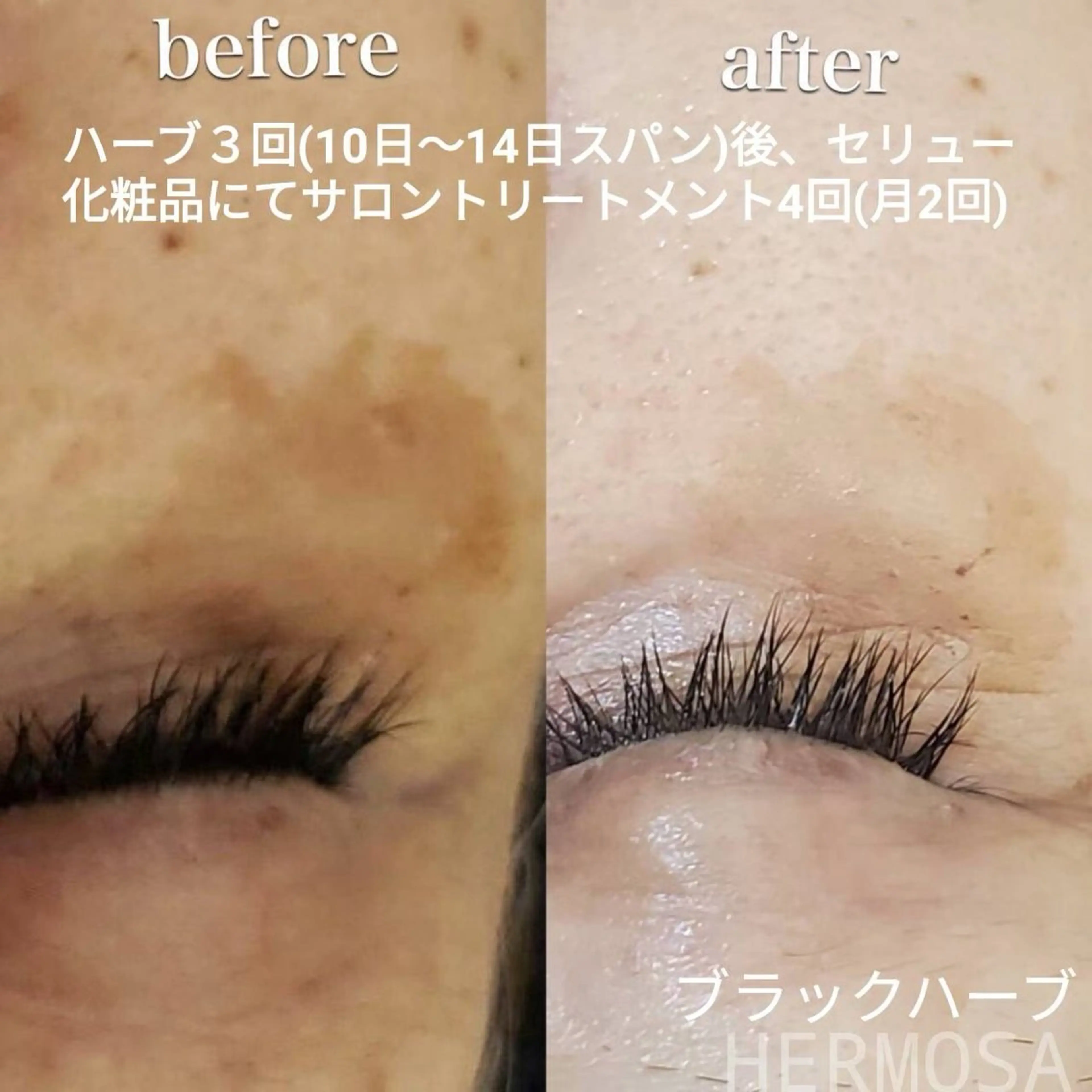 オールハンド フェイシャルのエステ・リラクイメージ