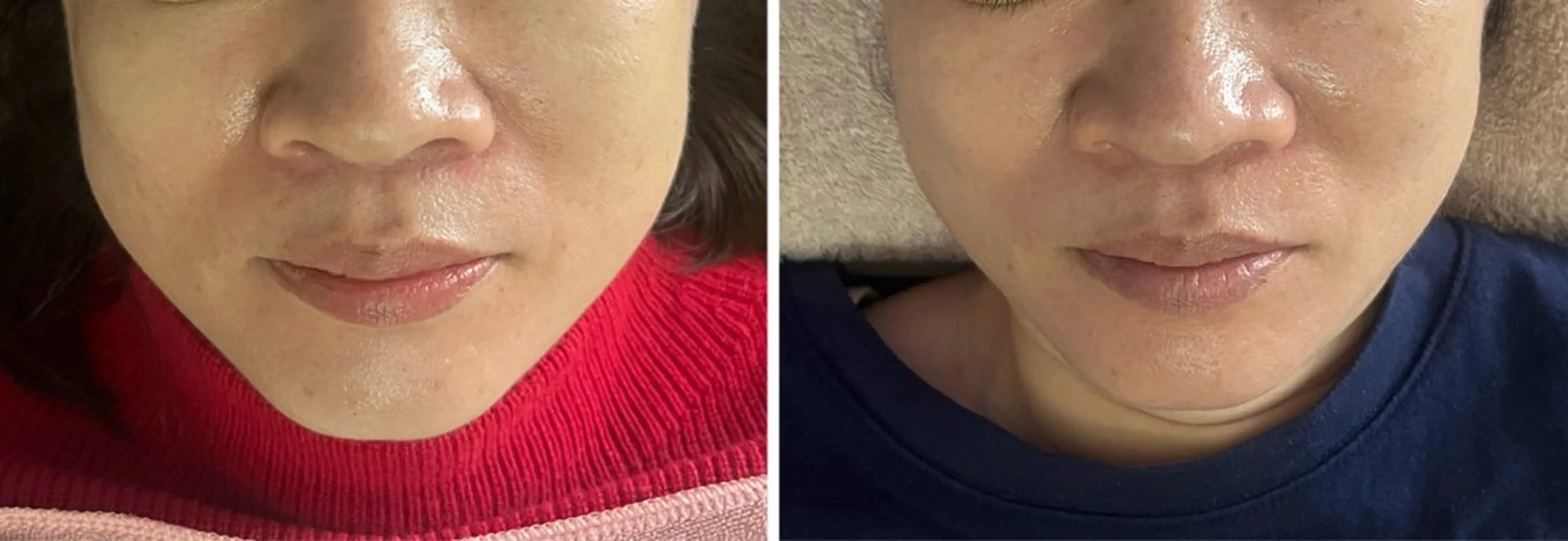 アロマ･美容鍼･カッ ピング「麗」鍼灸院のエステ・リラクイメージ