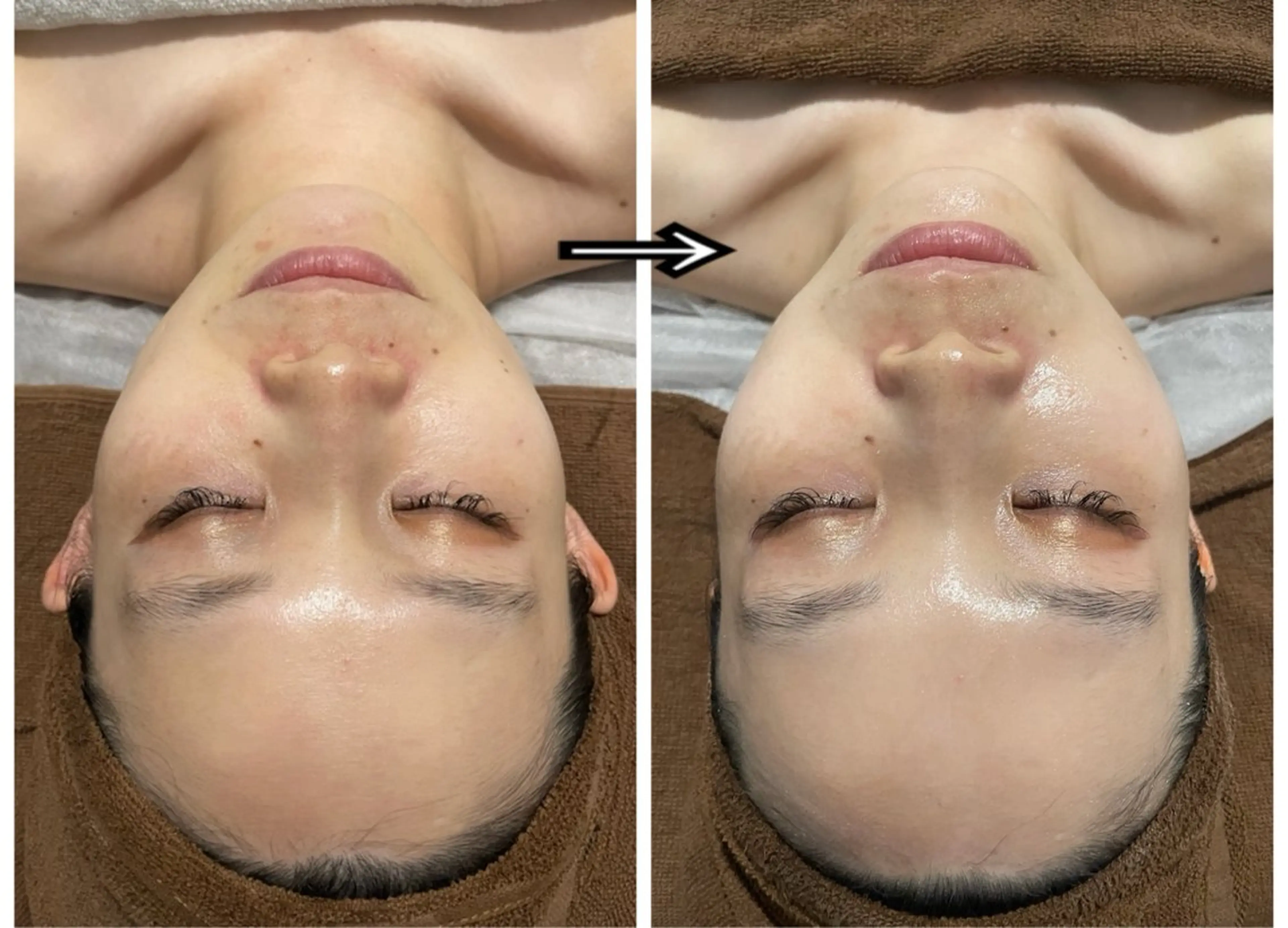 その他 ENCHANT 脱毛.小顔.毛穴のエステ・リラクイメージ