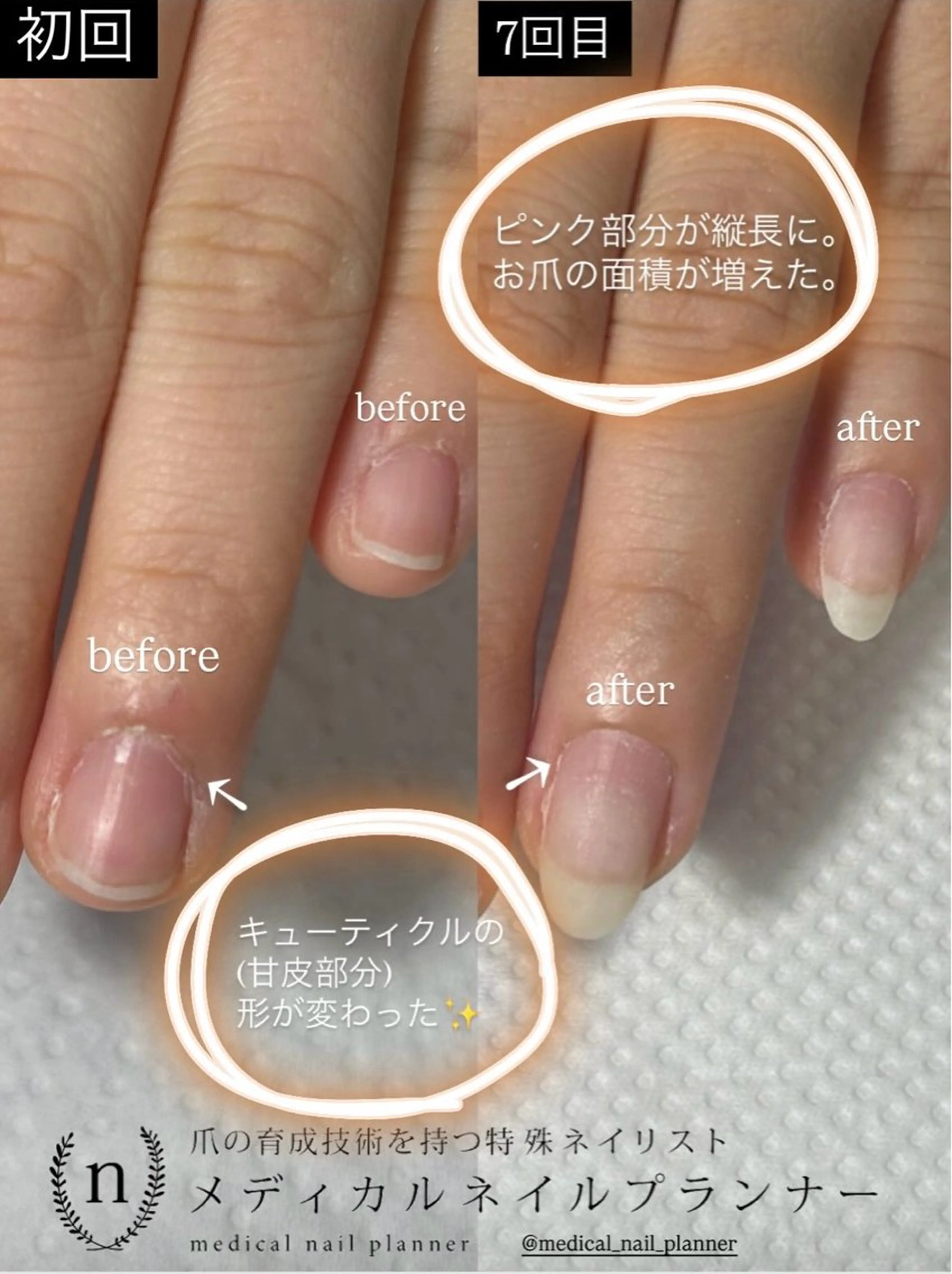 ネイル ハンドネイル Lofinails ちひろのネイルデザイン