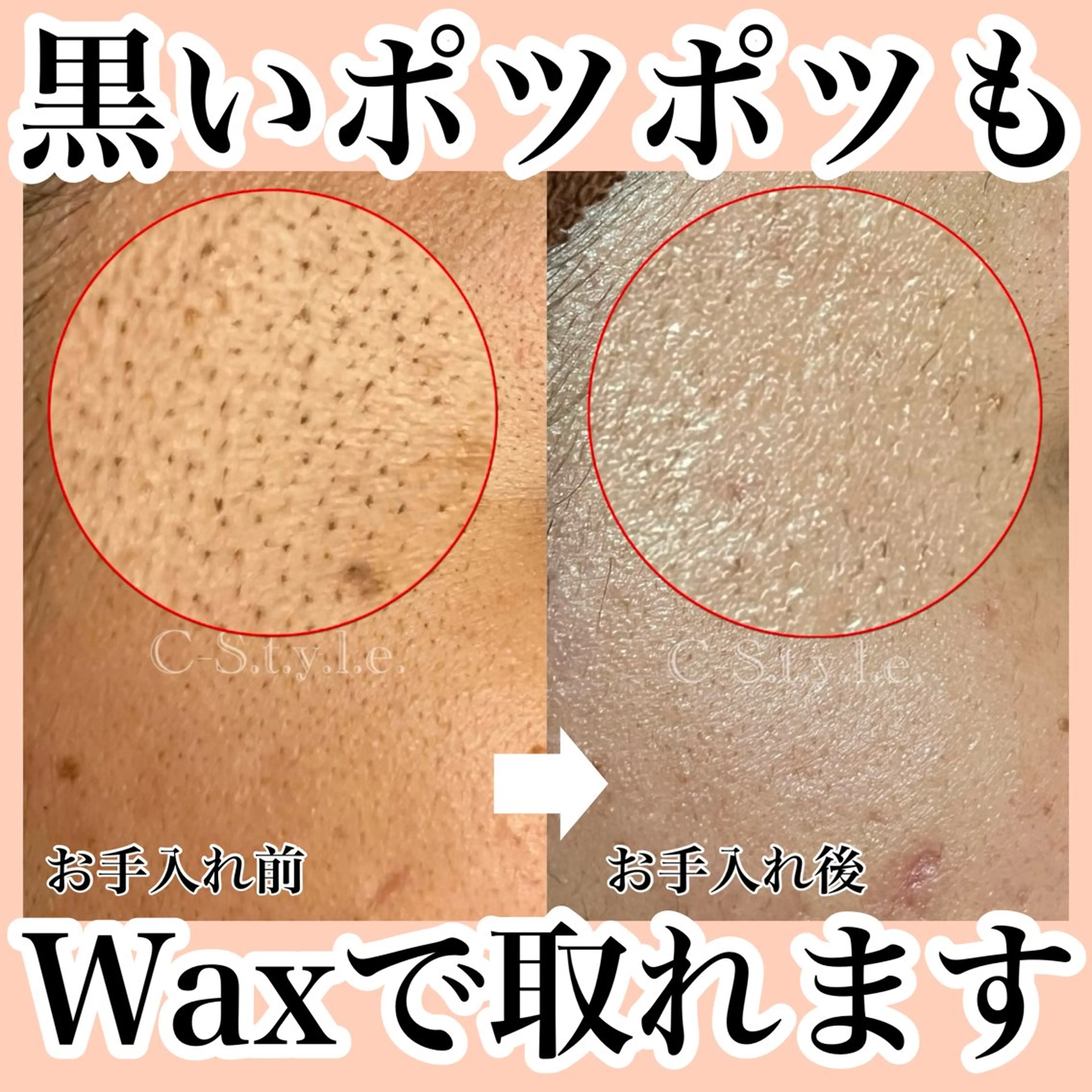 脱毛 エステサロン C- S.t.y.l.e.のエステ・リラクイメージ