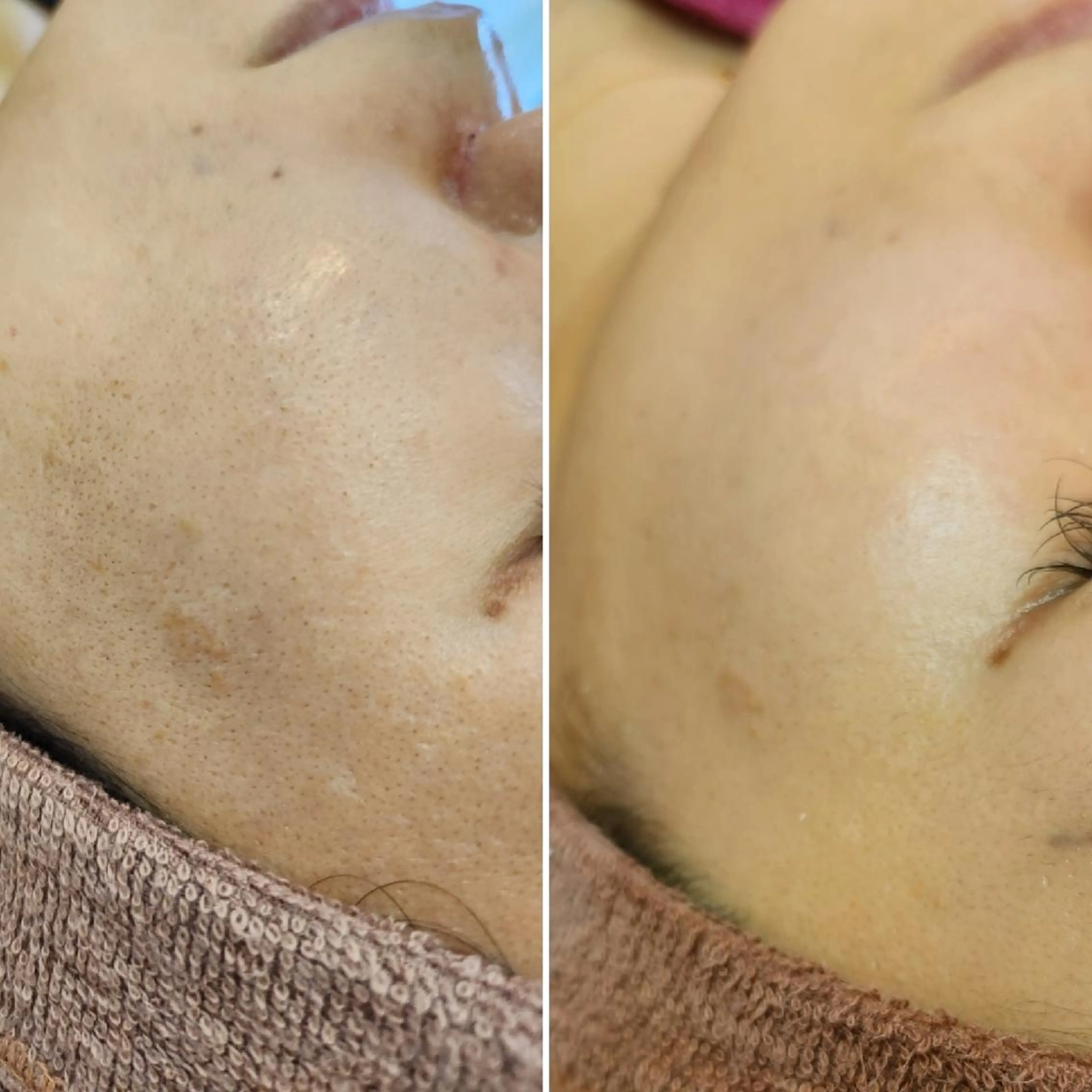 マツエク・マツパ アイブロウ ネイル 脱毛 Anacia Beauty Salon所属・美肌脱毛&毛穴専門 Anaciaのエステ・リラクイメージ