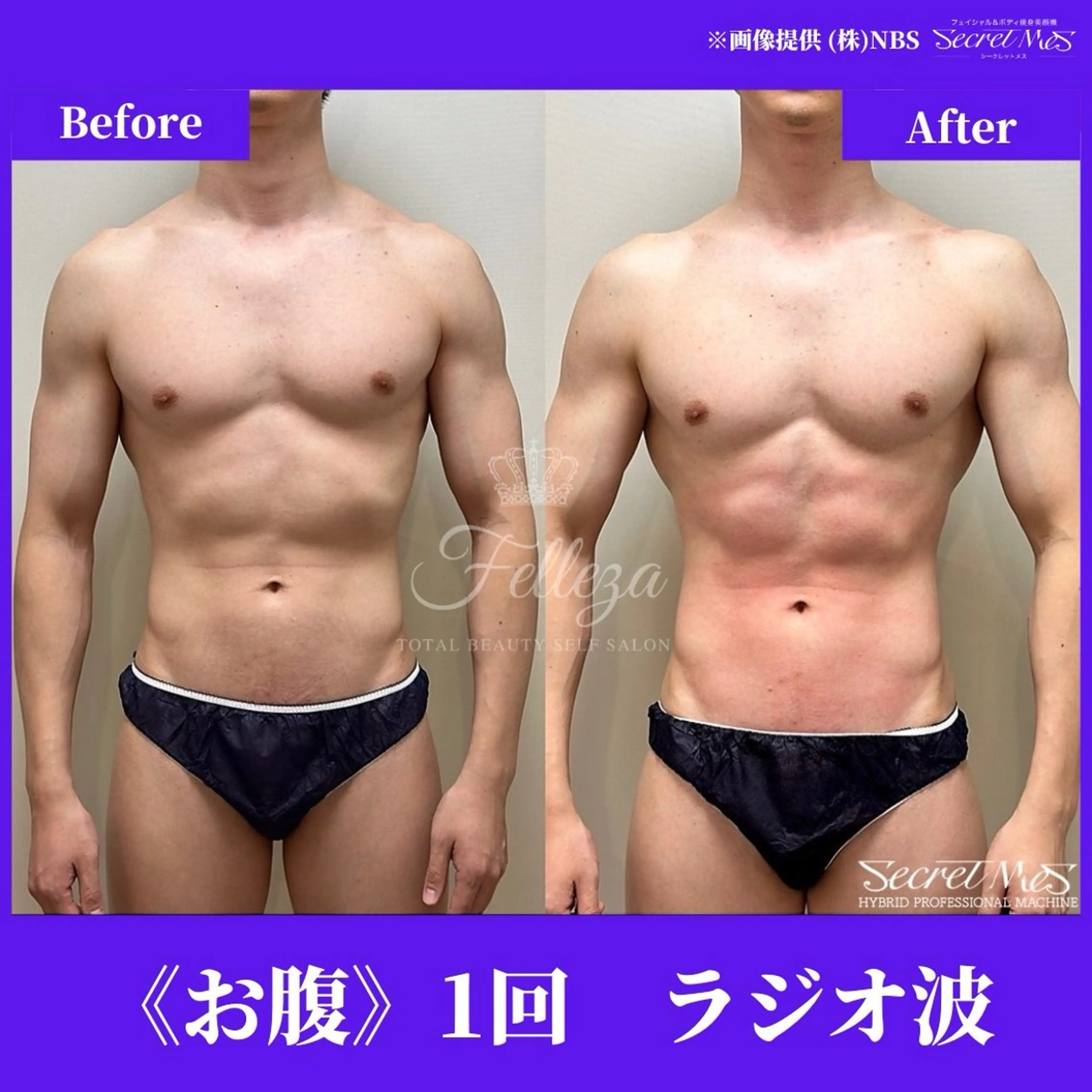 メンズ 有人型セルフサロン 脱毛／痩身／美顔のその他イメージ