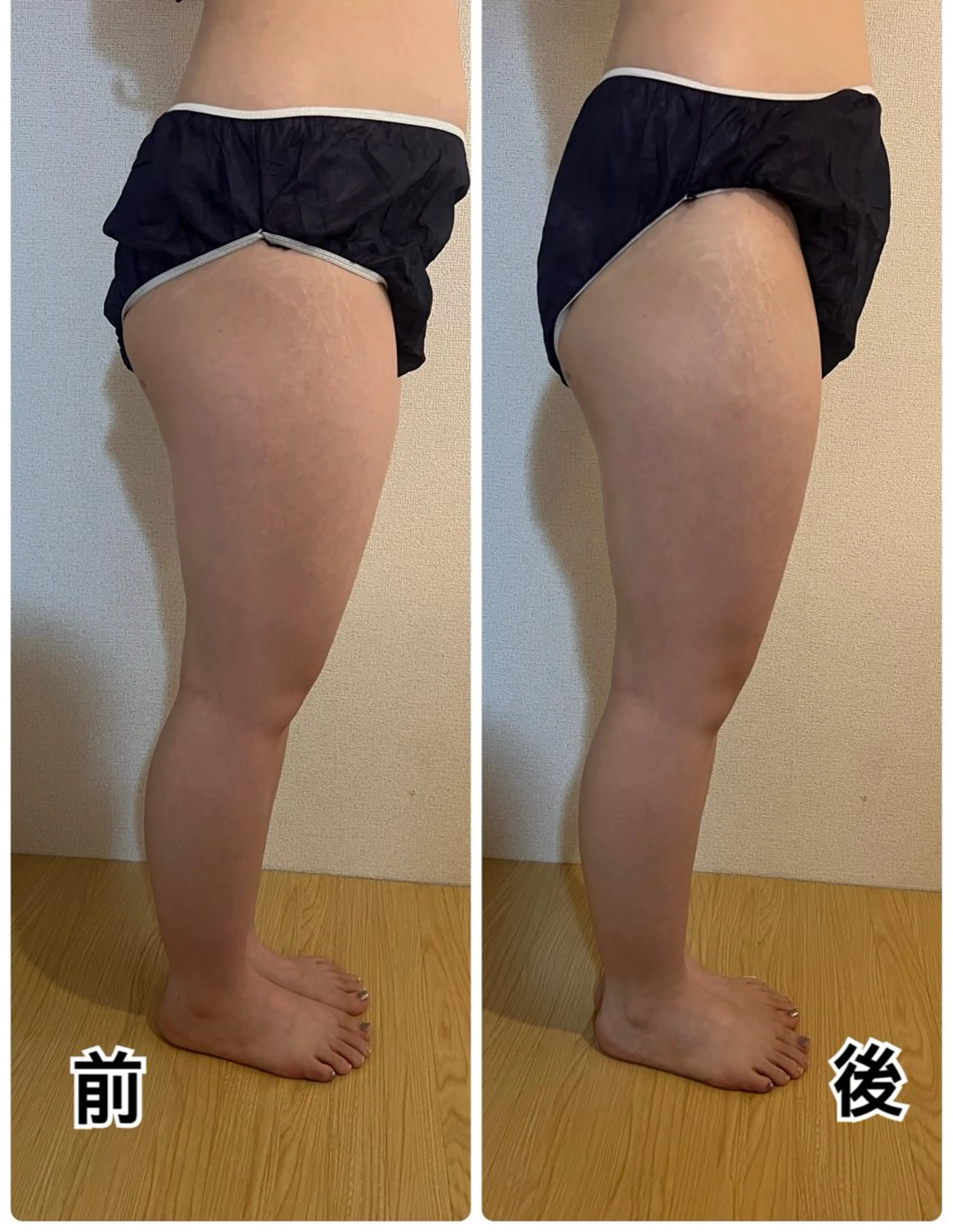 ❤︎MN❤︎ モンのエステ・リラクイメージ