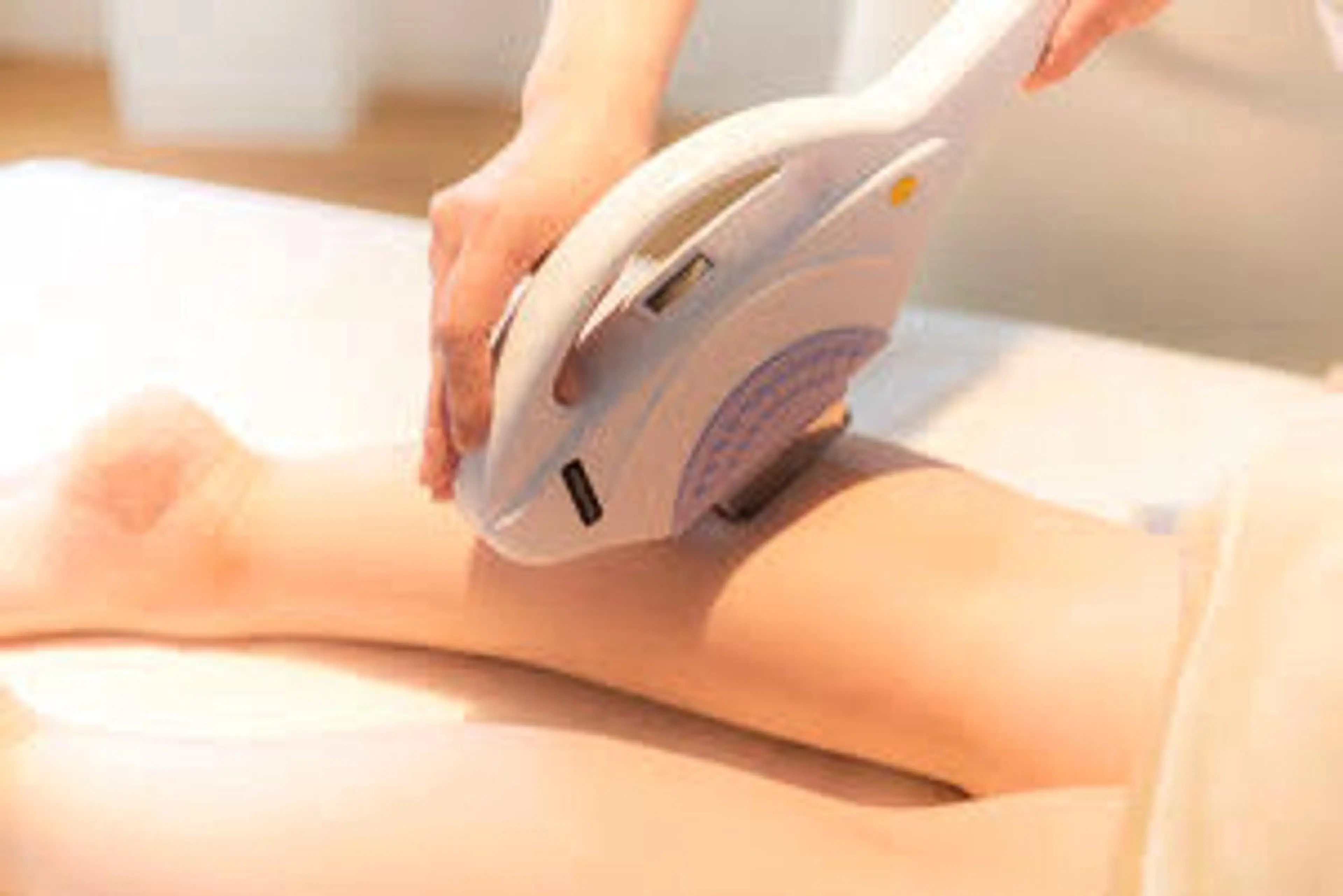 Sパーツ(女性限定脱毛)の写真