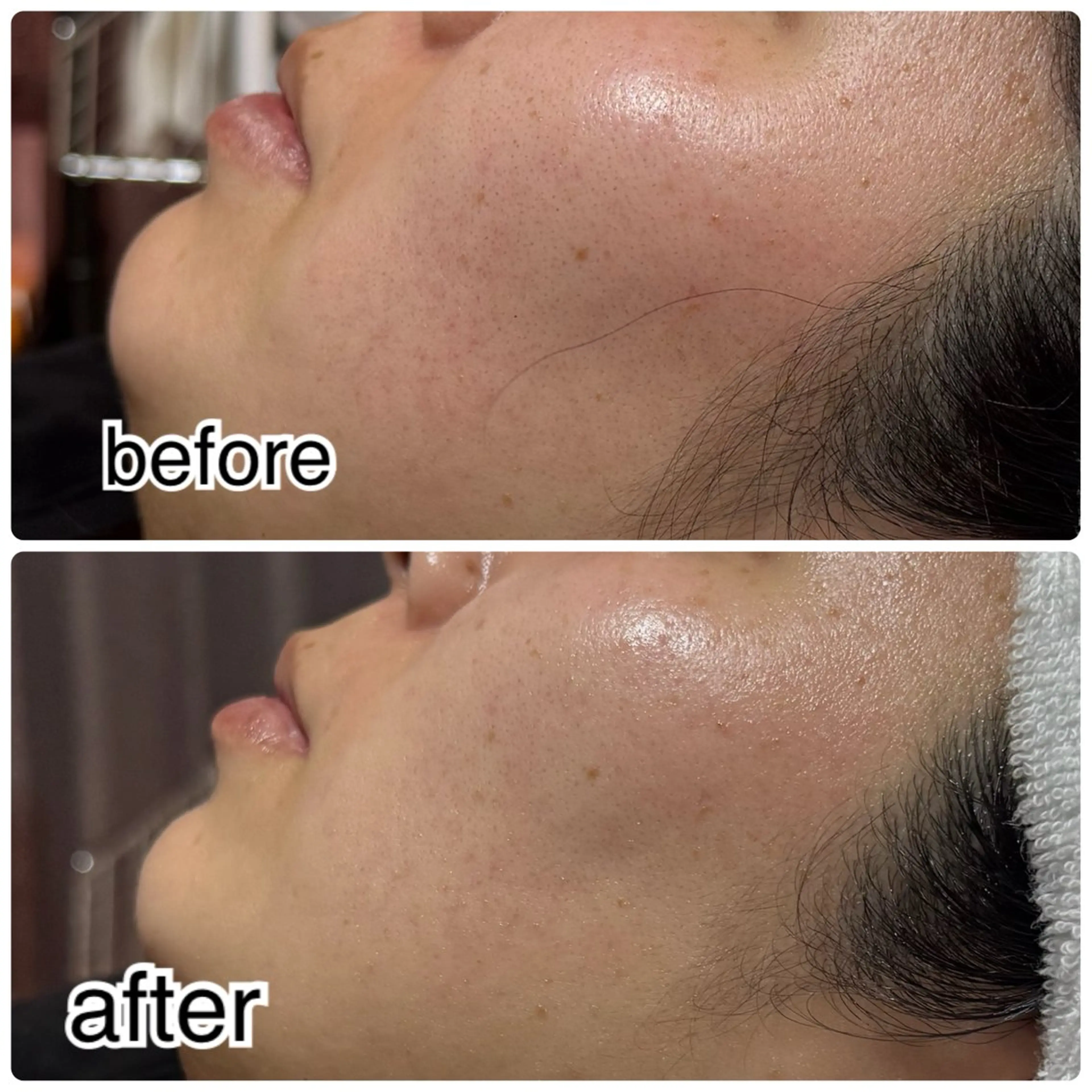 エステ ROR所属・ROR nailのエステ・リラクイメージ