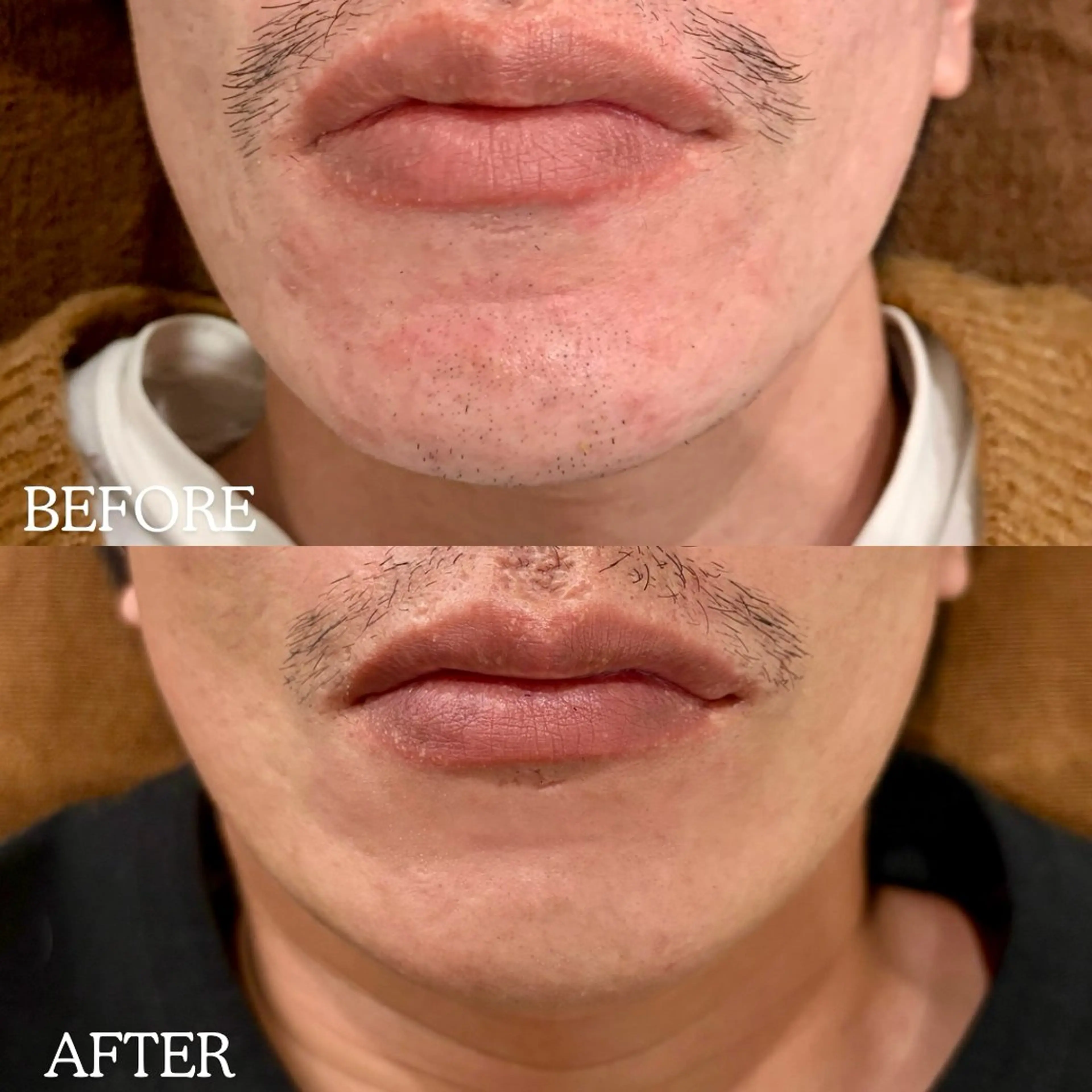 メンズ 脱毛 RICCO 堺東所属・RICCO 堺の眉毛・アイブロウイメージ