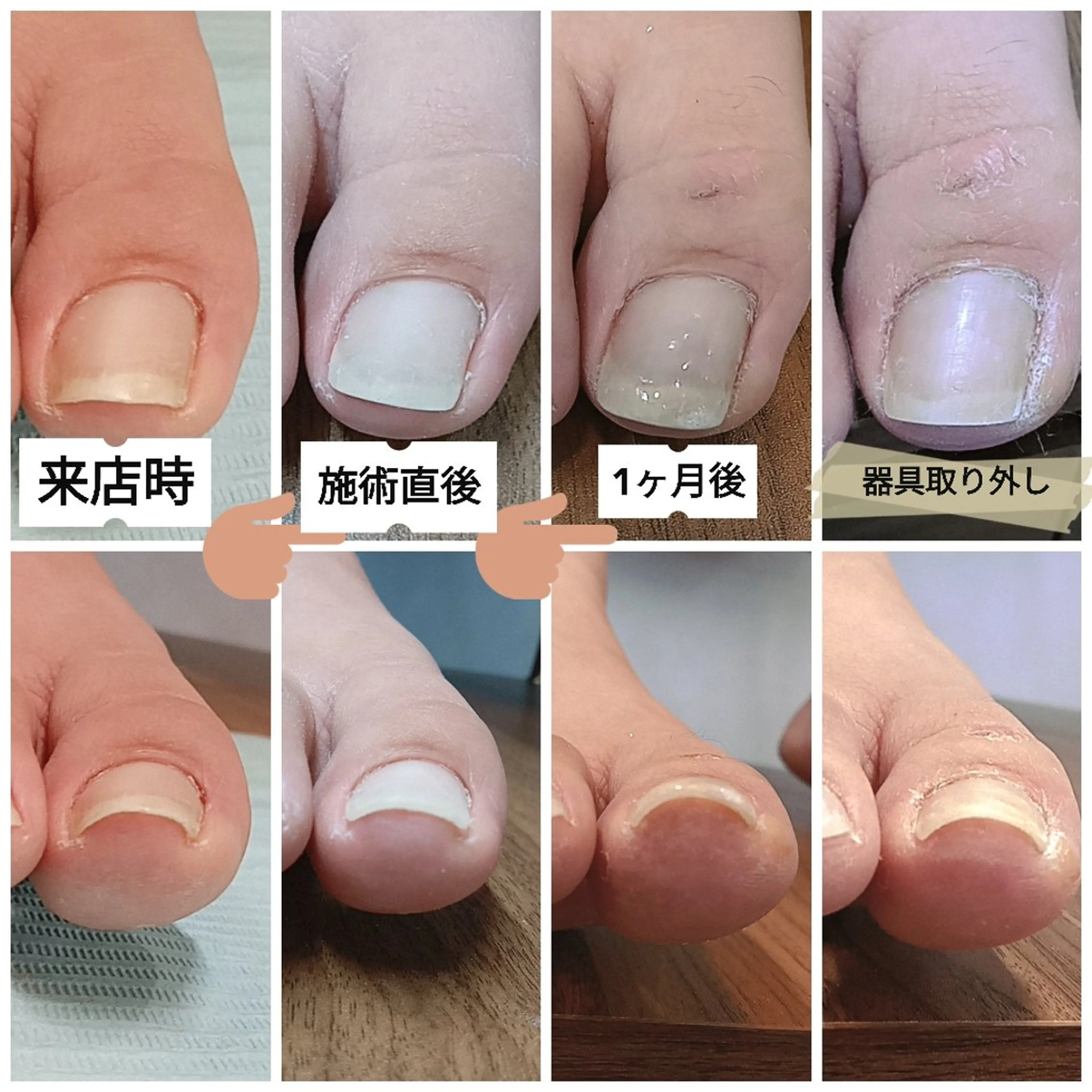 ネイル その他 フットケアルーム ~KaPilina~のその他イメージ