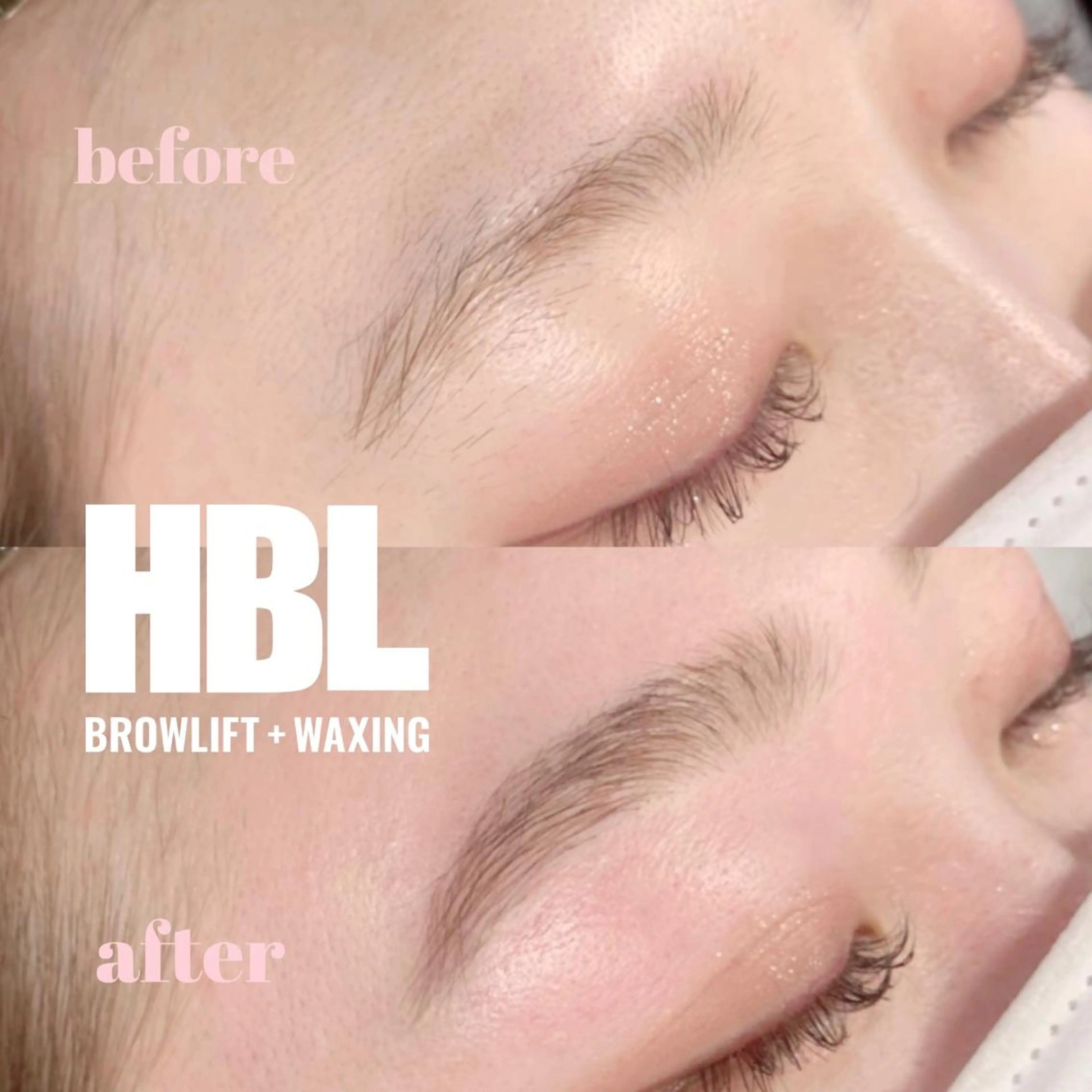 ハリウッドブロウリフト！！(鎮静ケア付き)※新規男性の方×の写真