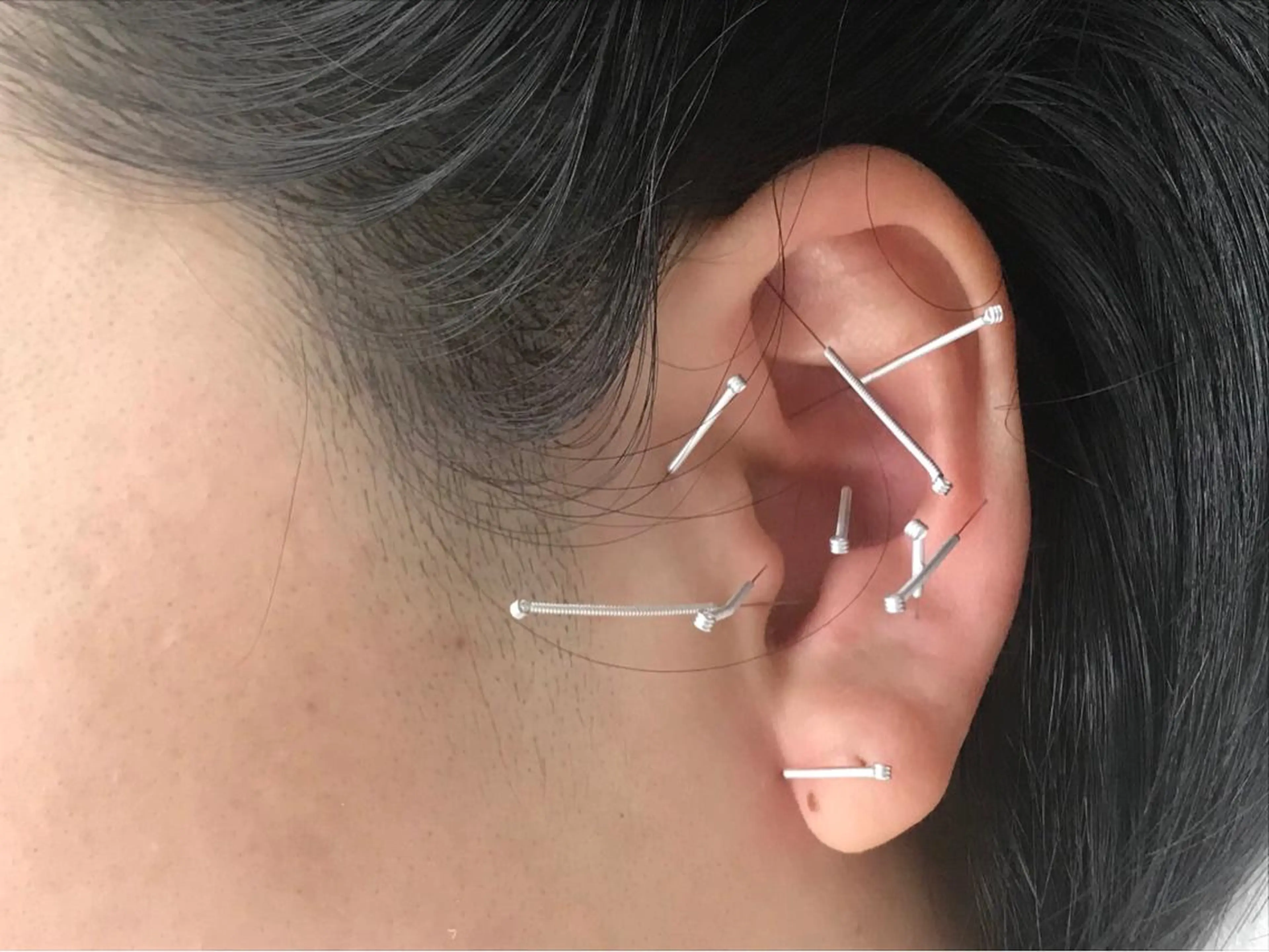 🌈耳鍼👂［ツボ］療法🌈の写真