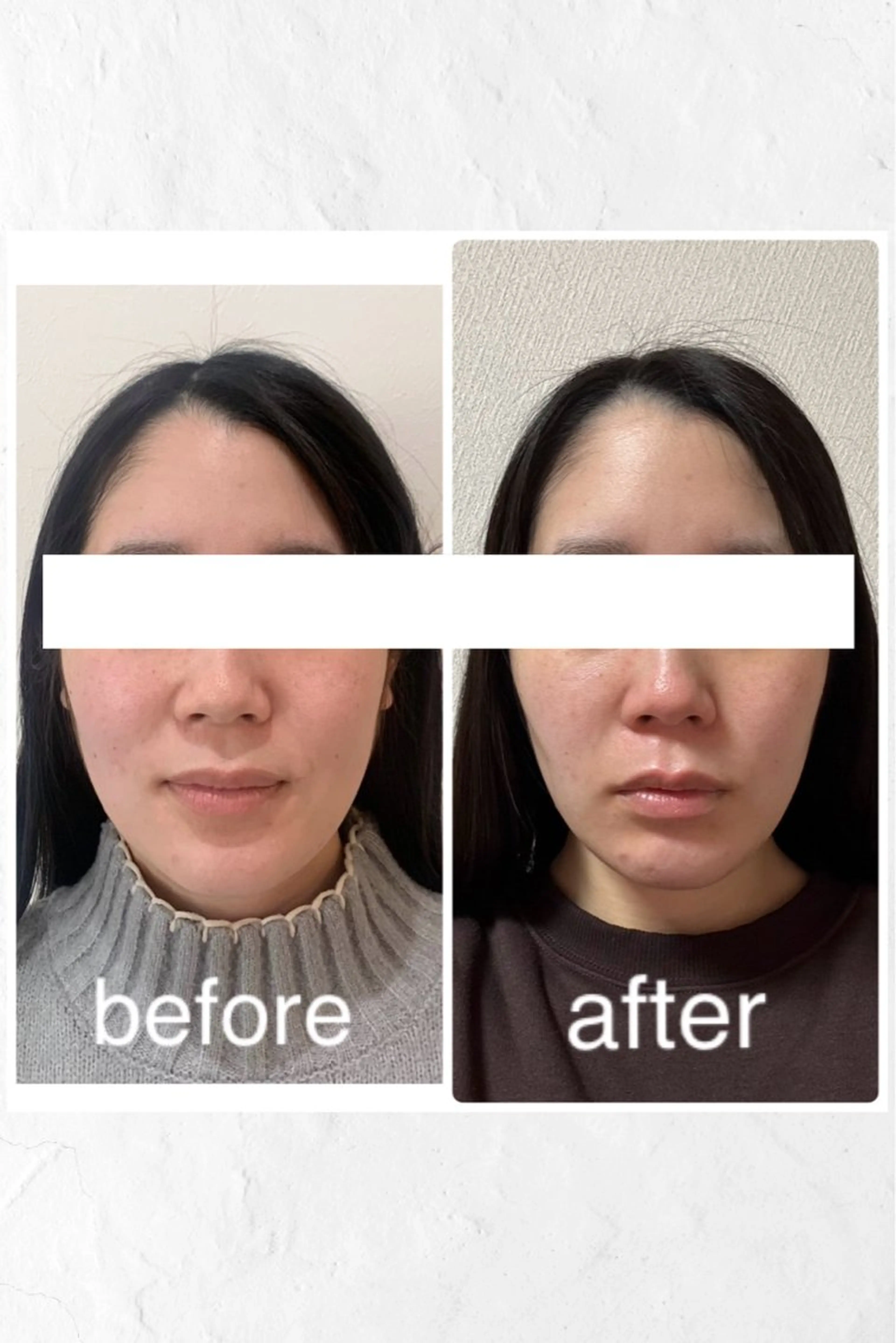 エステ リラク 小顔と ヘッドスパのお店のエステ・リラクイメージ