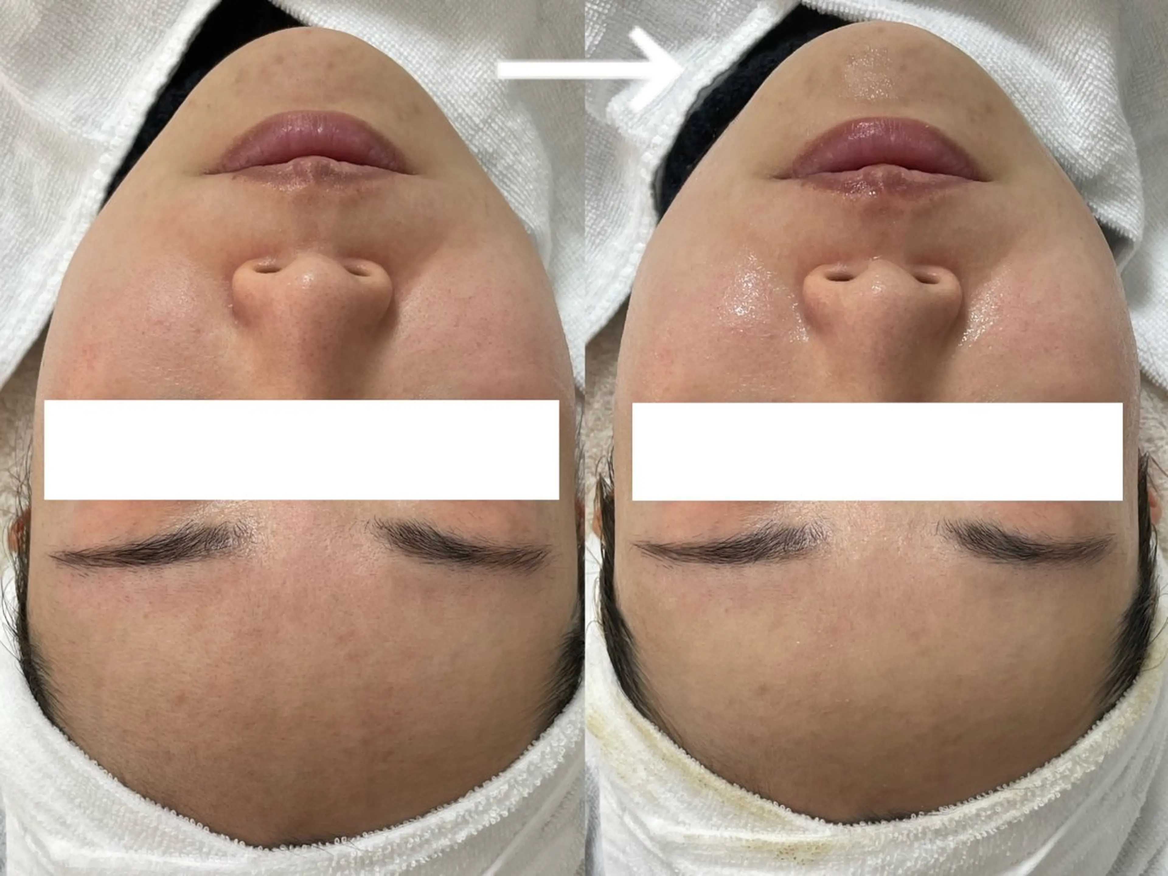 private salon éclat所属・ニキビ・毛穴専門 éclat/エクラのエステ・リラクイメージ