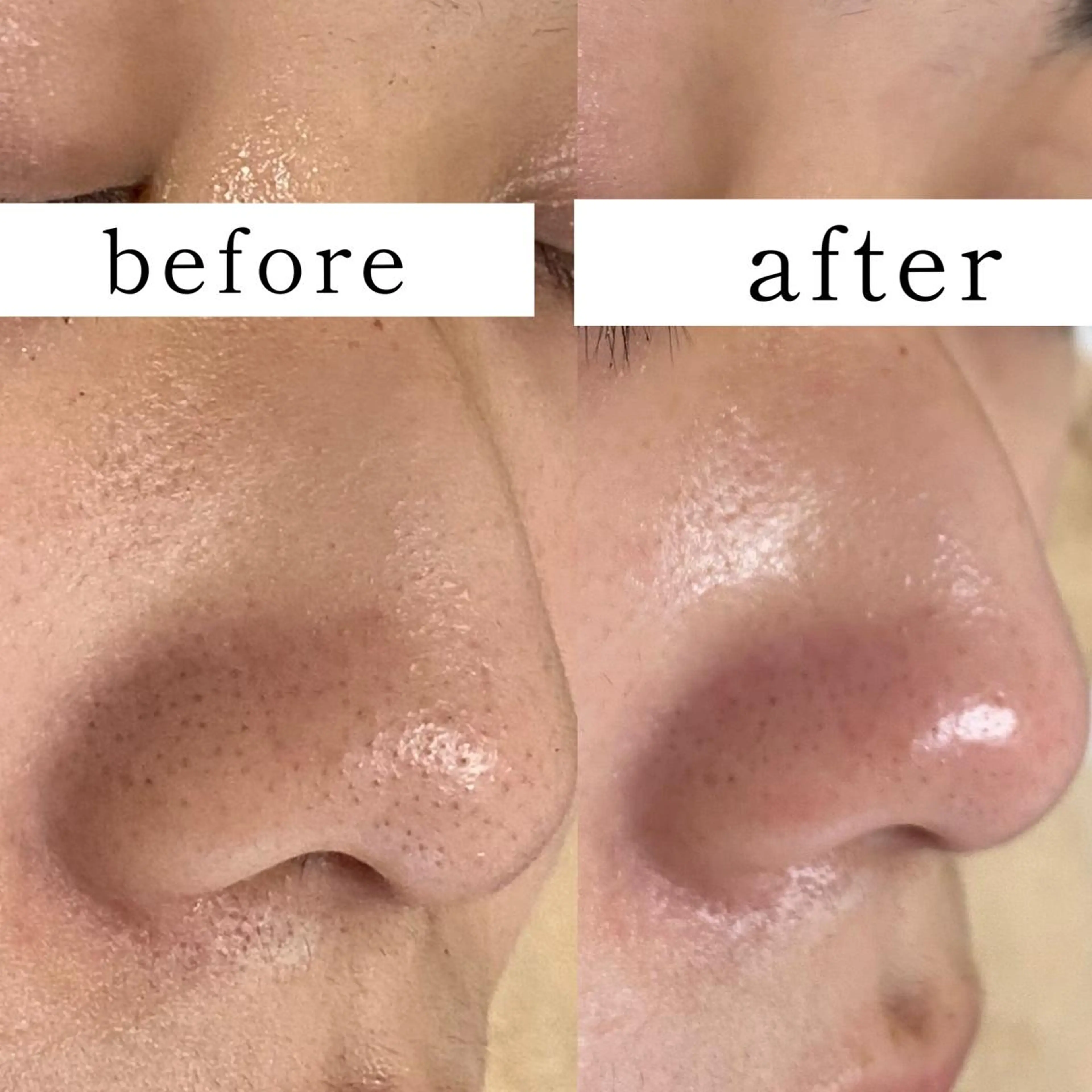 毛穴専門サロン フルール所属・フルールFululu 自由が丘のエステ・リラクイメージ