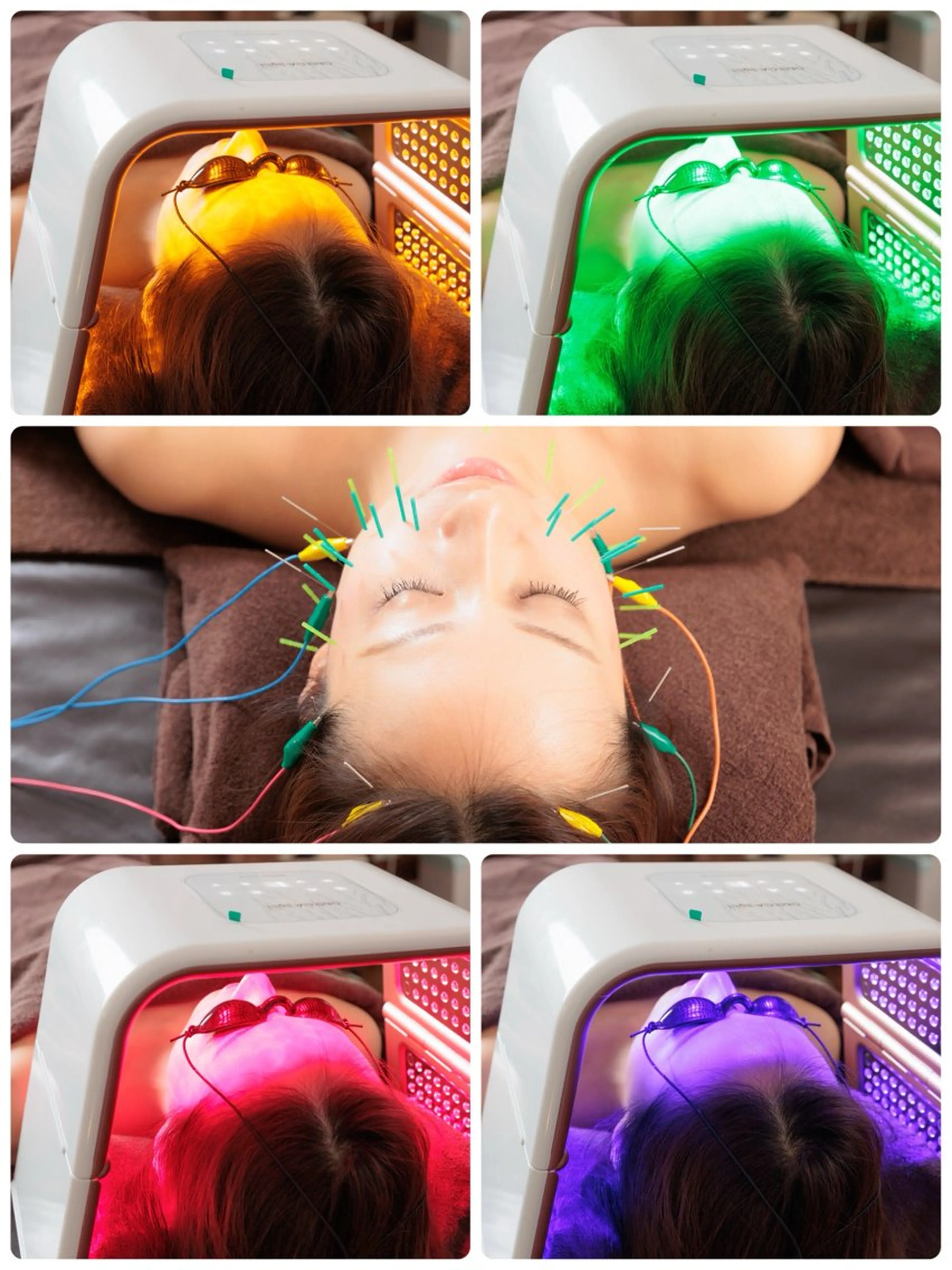 美容鍼✖️LED光美容💗🪡💙お肌が喜ぶ光のチカラ🌈と内側からの鍼ケア✨の写真