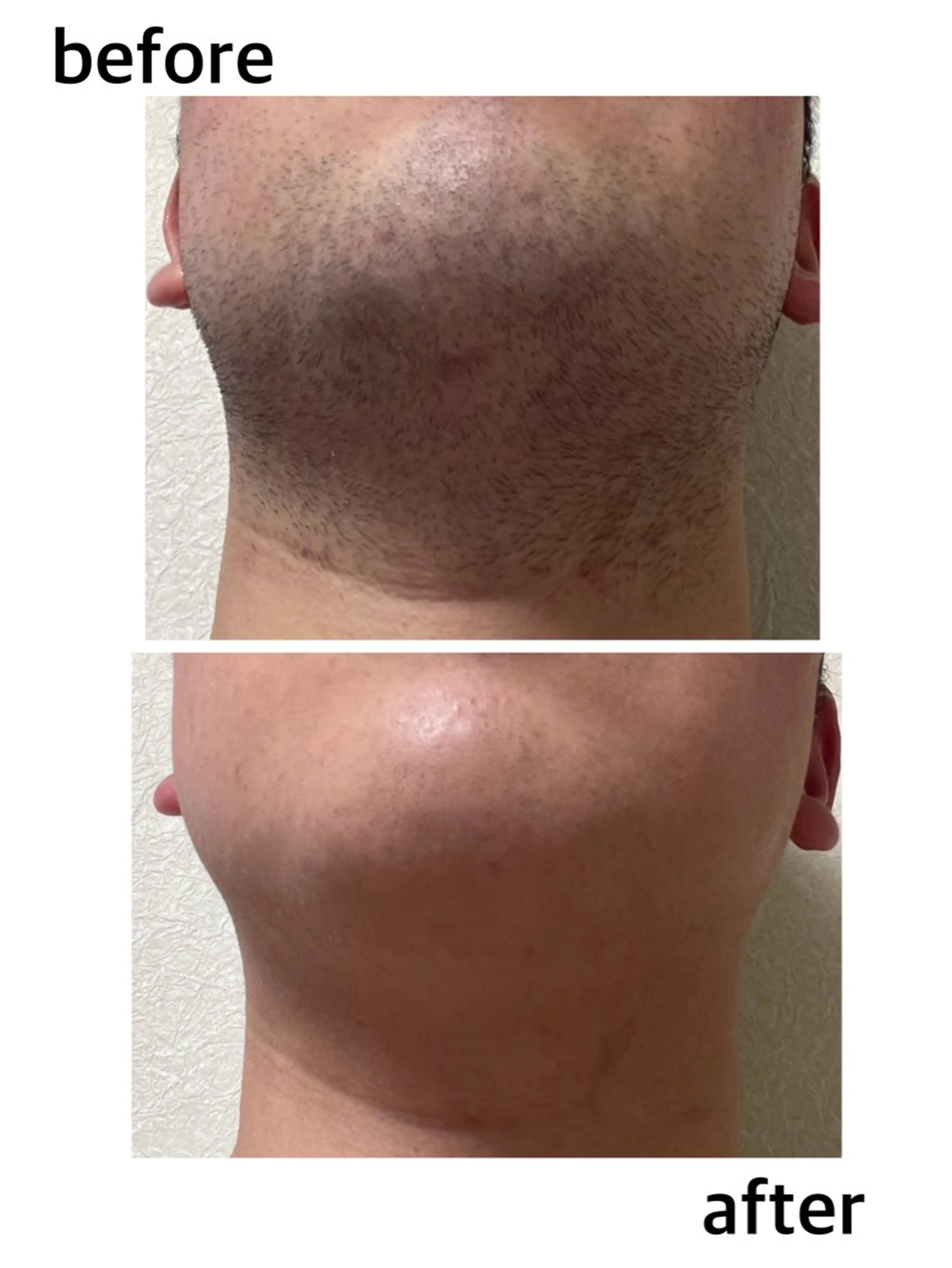 メンズ PROSOL こころのエステ・リラクイメージ