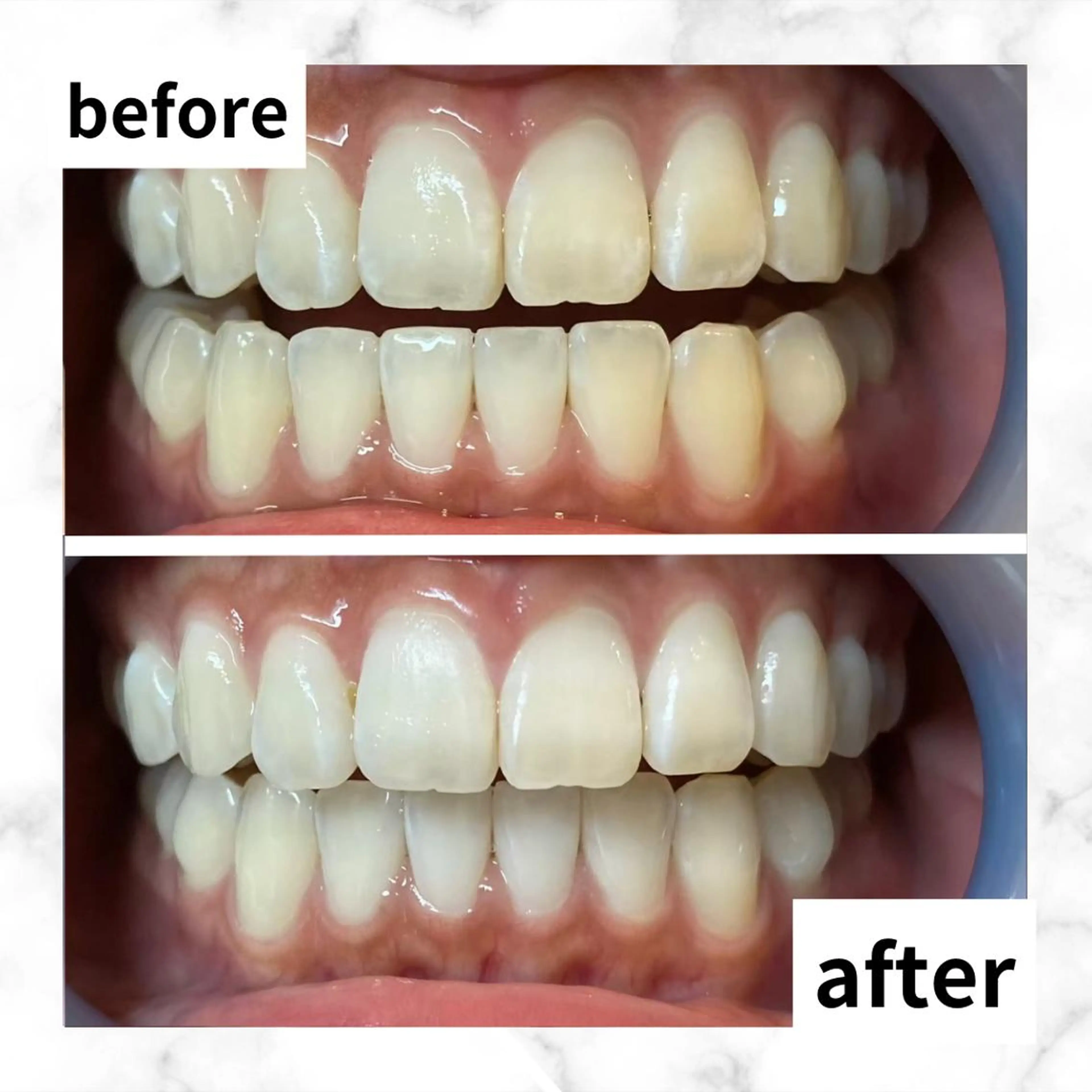 LBSホワイトニング 🌐渋谷店 河内のエステ・リラクイメージ