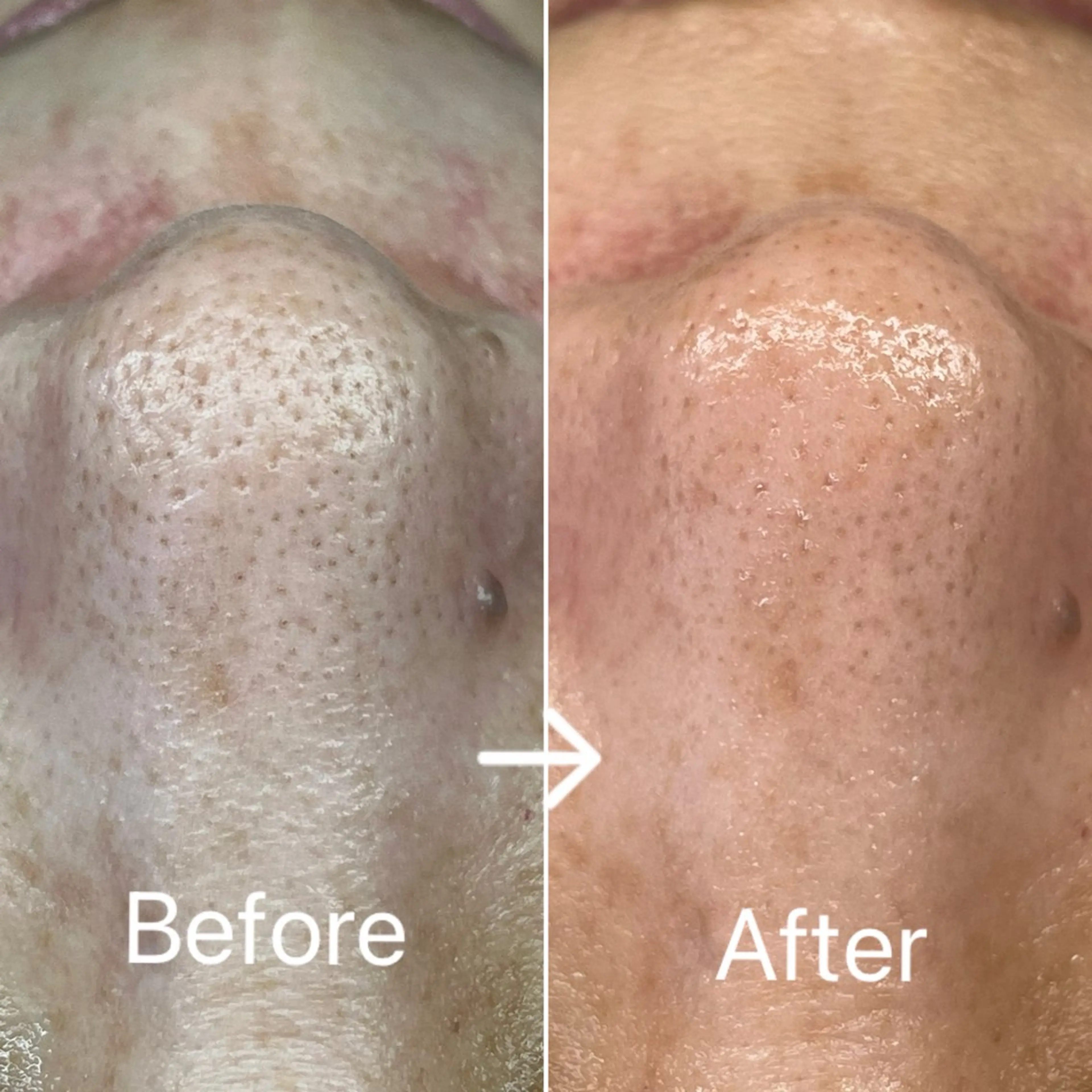 Blue Moon 【ブルームーン】のエステ・リラクイメージ