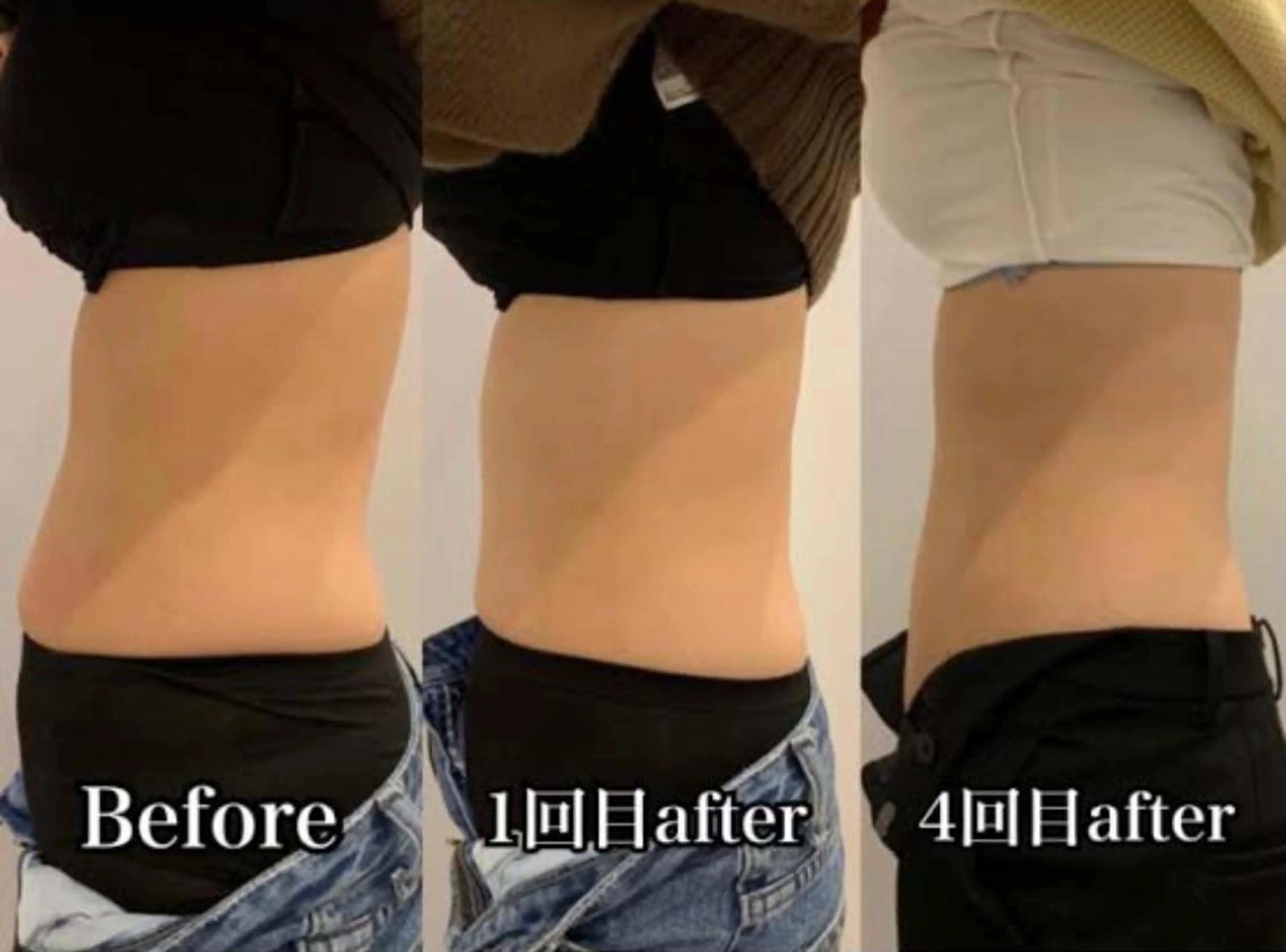 痩身/脱毛/ネイル HARUKAのエステ・リラクイメージ