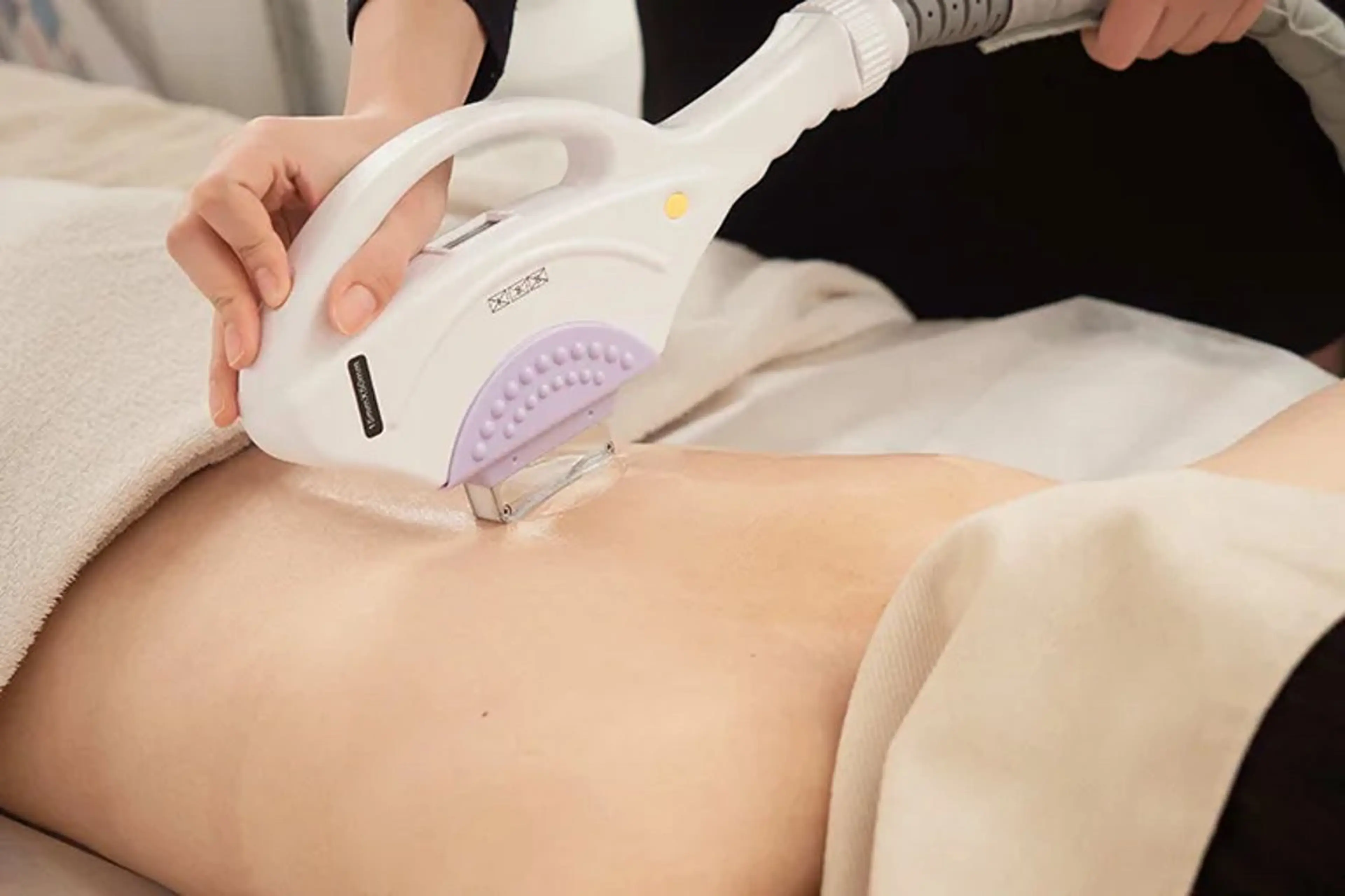 光脱毛Lパーツ【女性のみ】パーツ選んで1箇所脱毛の写真