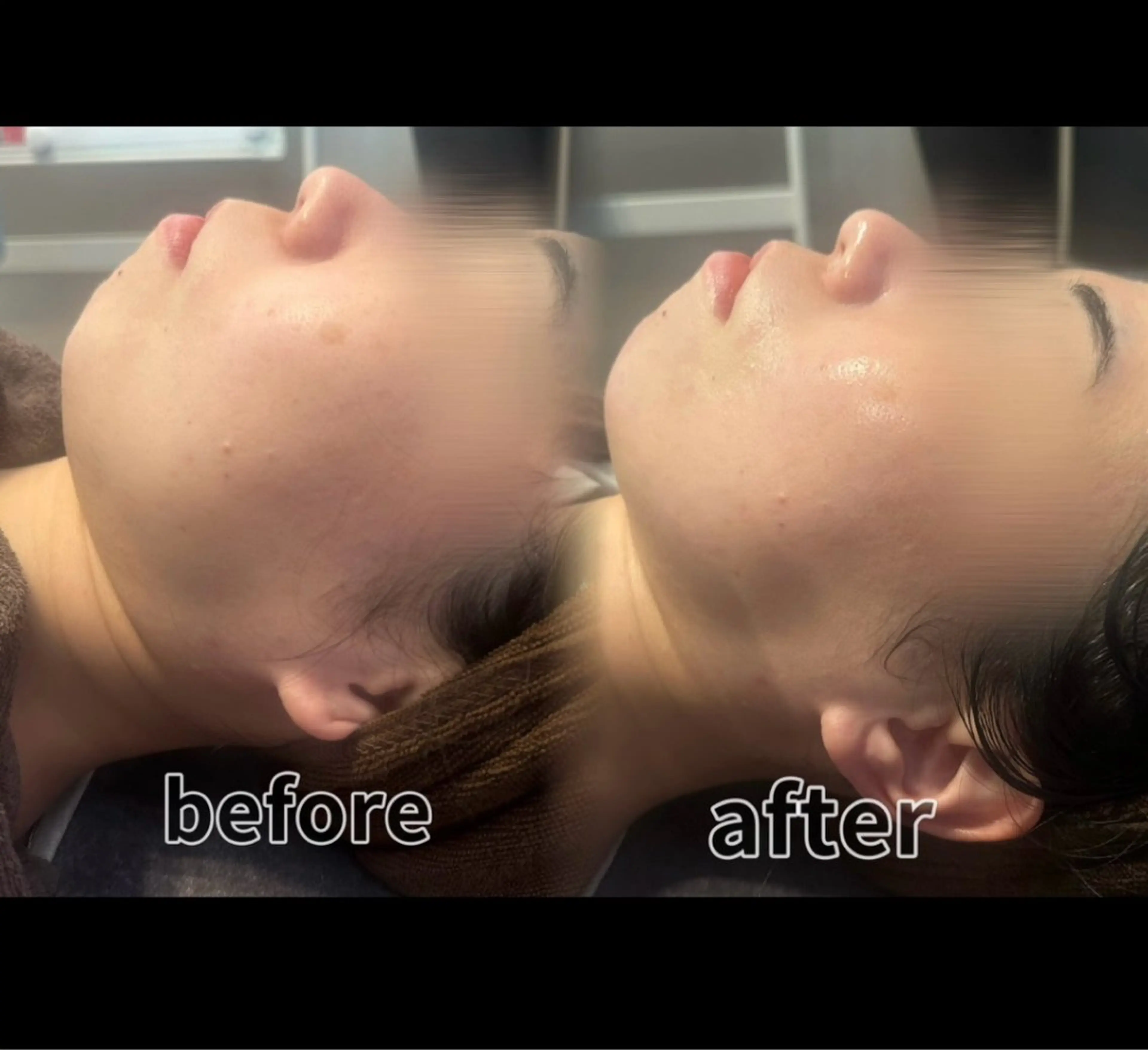 エステ リラク 浮腫|肩こり|張り 日々の疲れを解消⭐️のエステ・リラクイメージ